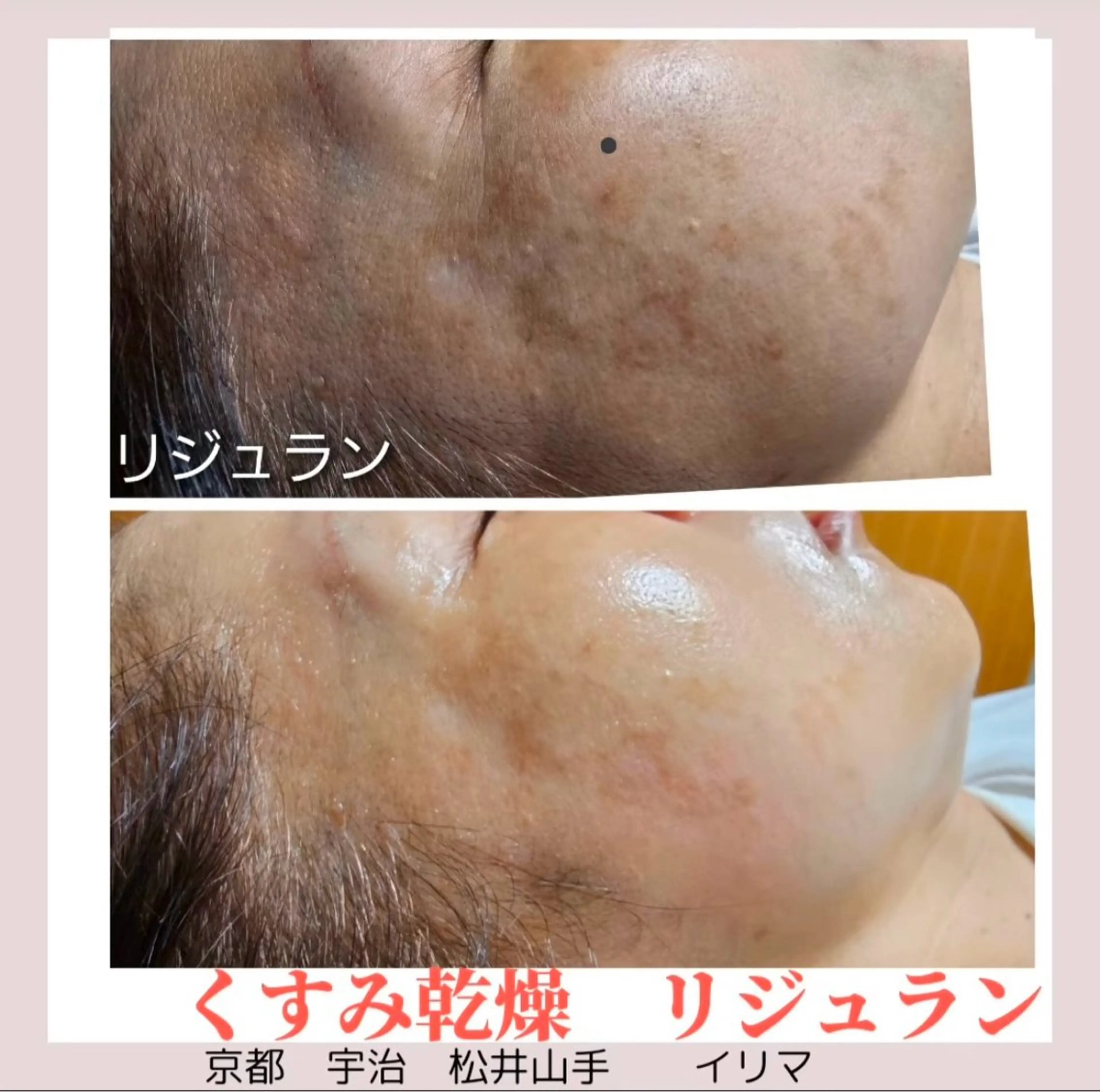 ilima NARUMIのエステ・リラクイメージ