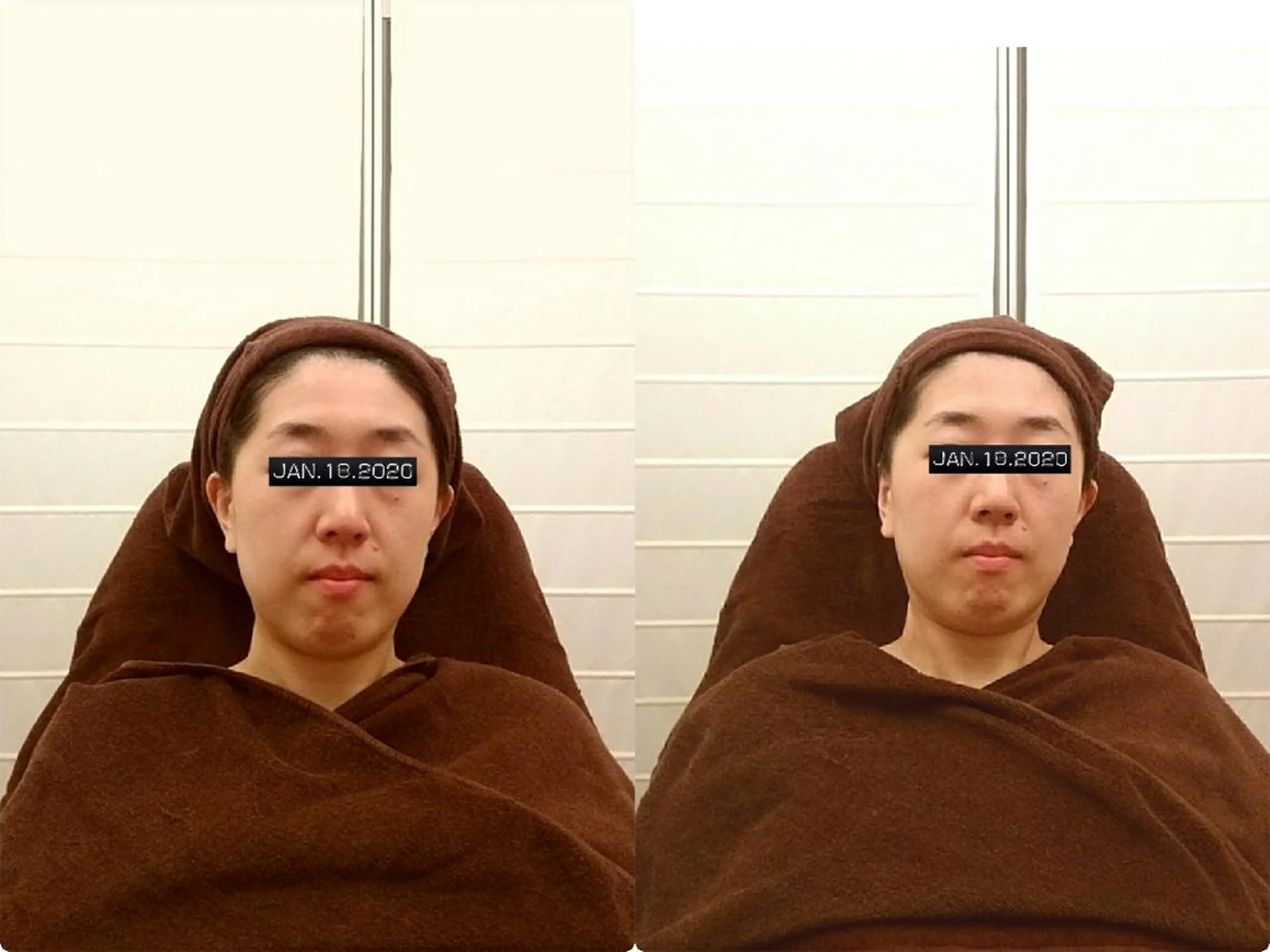 エステ machiyama kazuyoのエステ・リラクイメージ