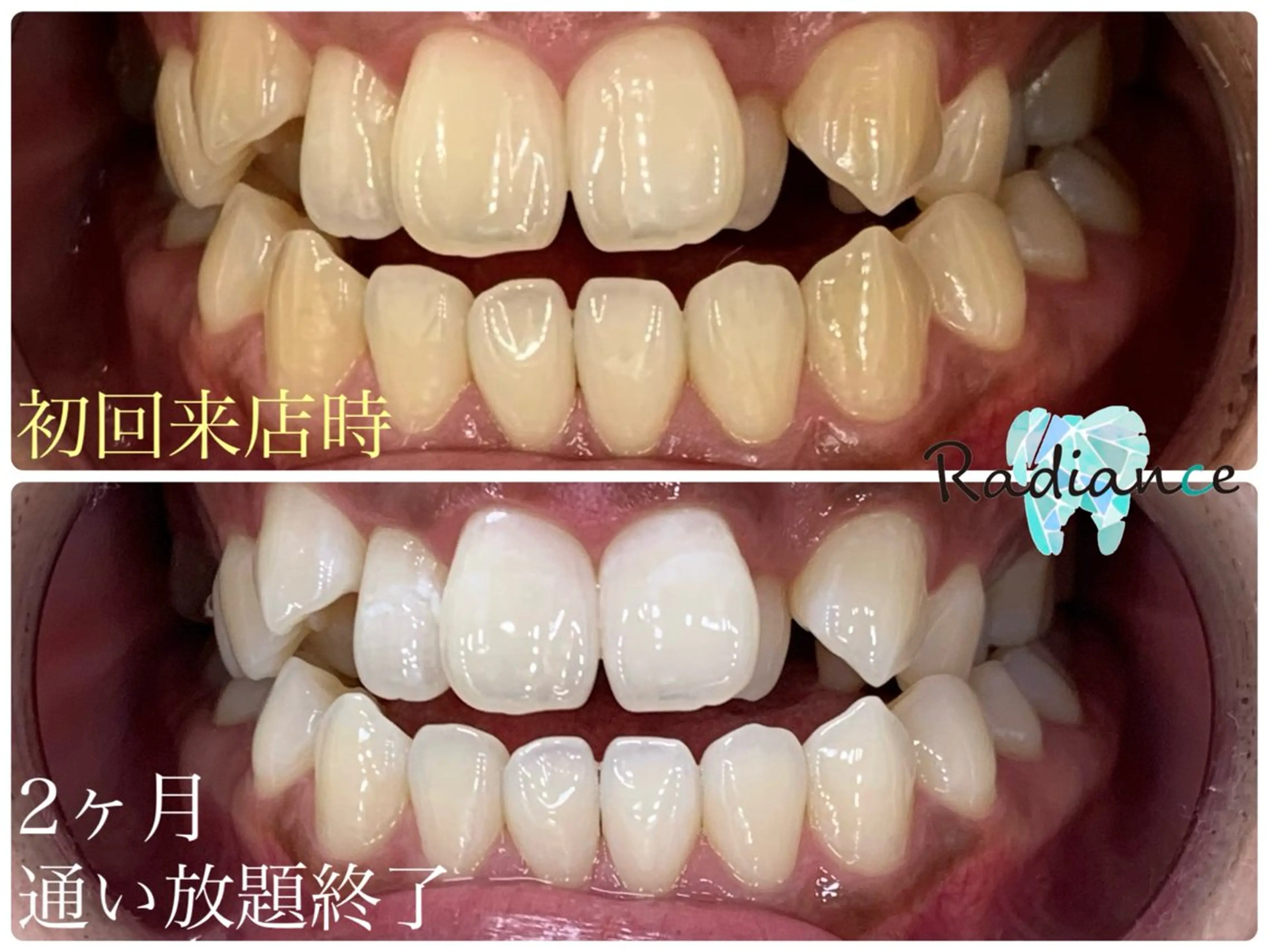 札幌ホワイトニング ラディアンス札幌駅店のその他イメージ