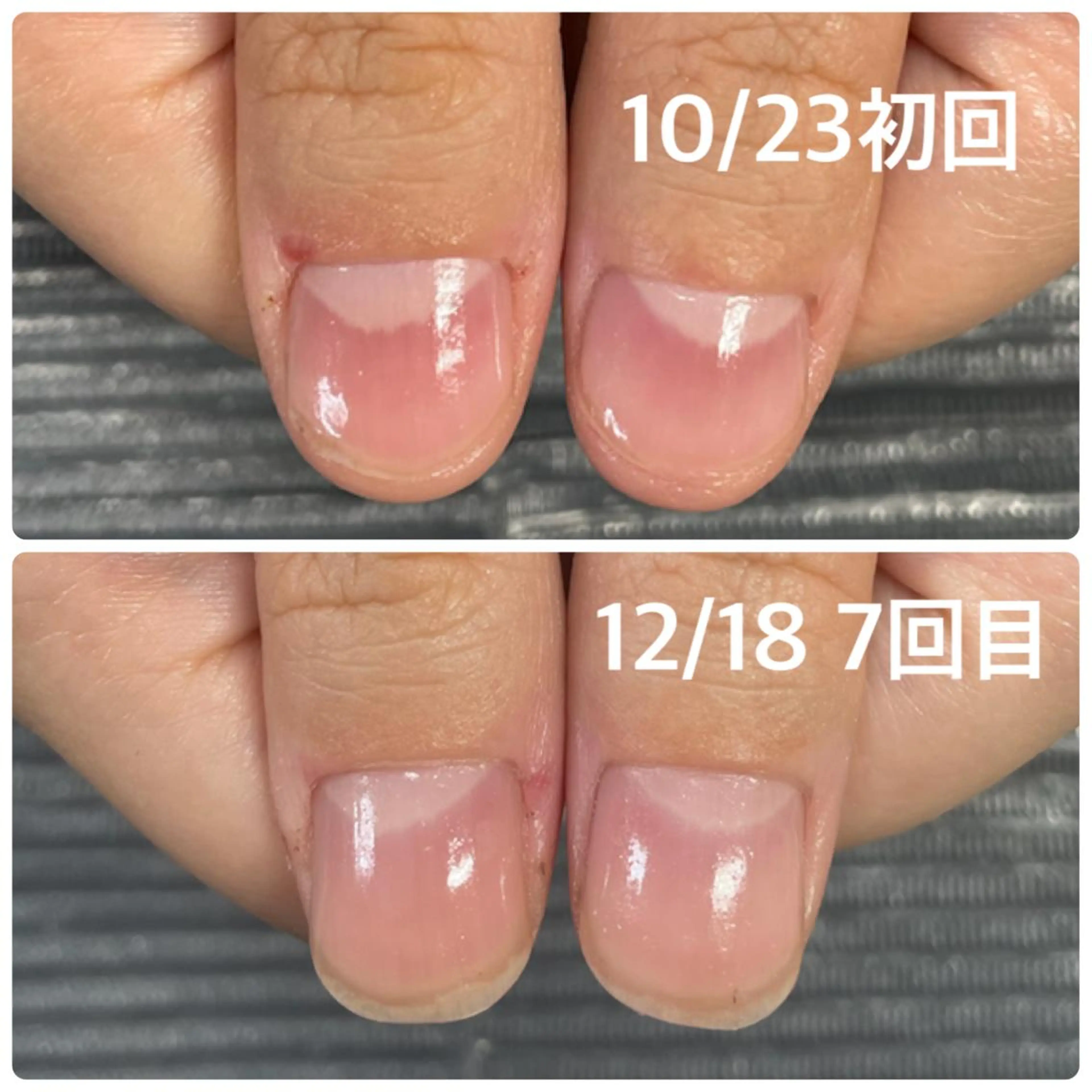 ネイル 奥園 良恵のネイルデザイン