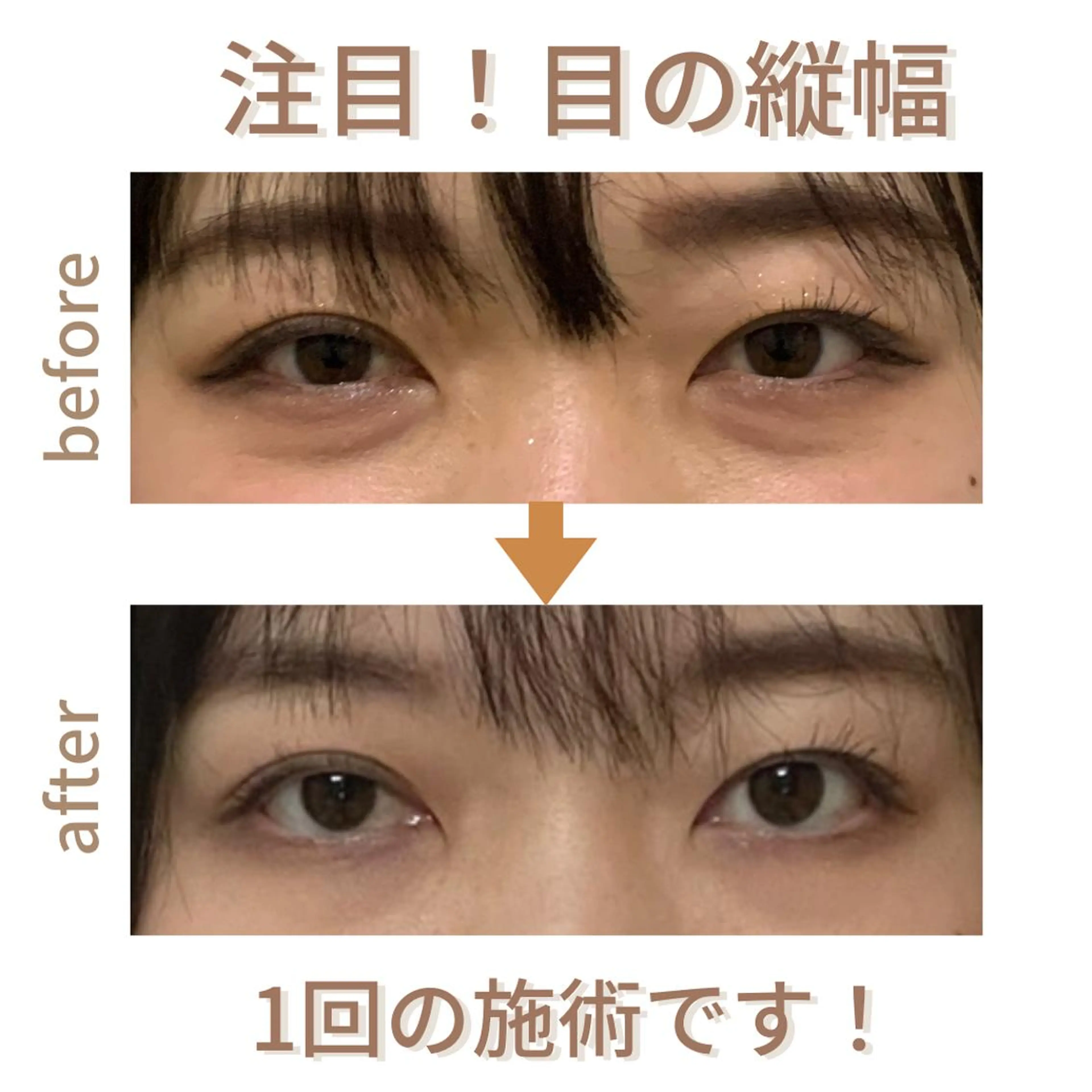 小顔サロン AMYONのエステ・リラクイメージ