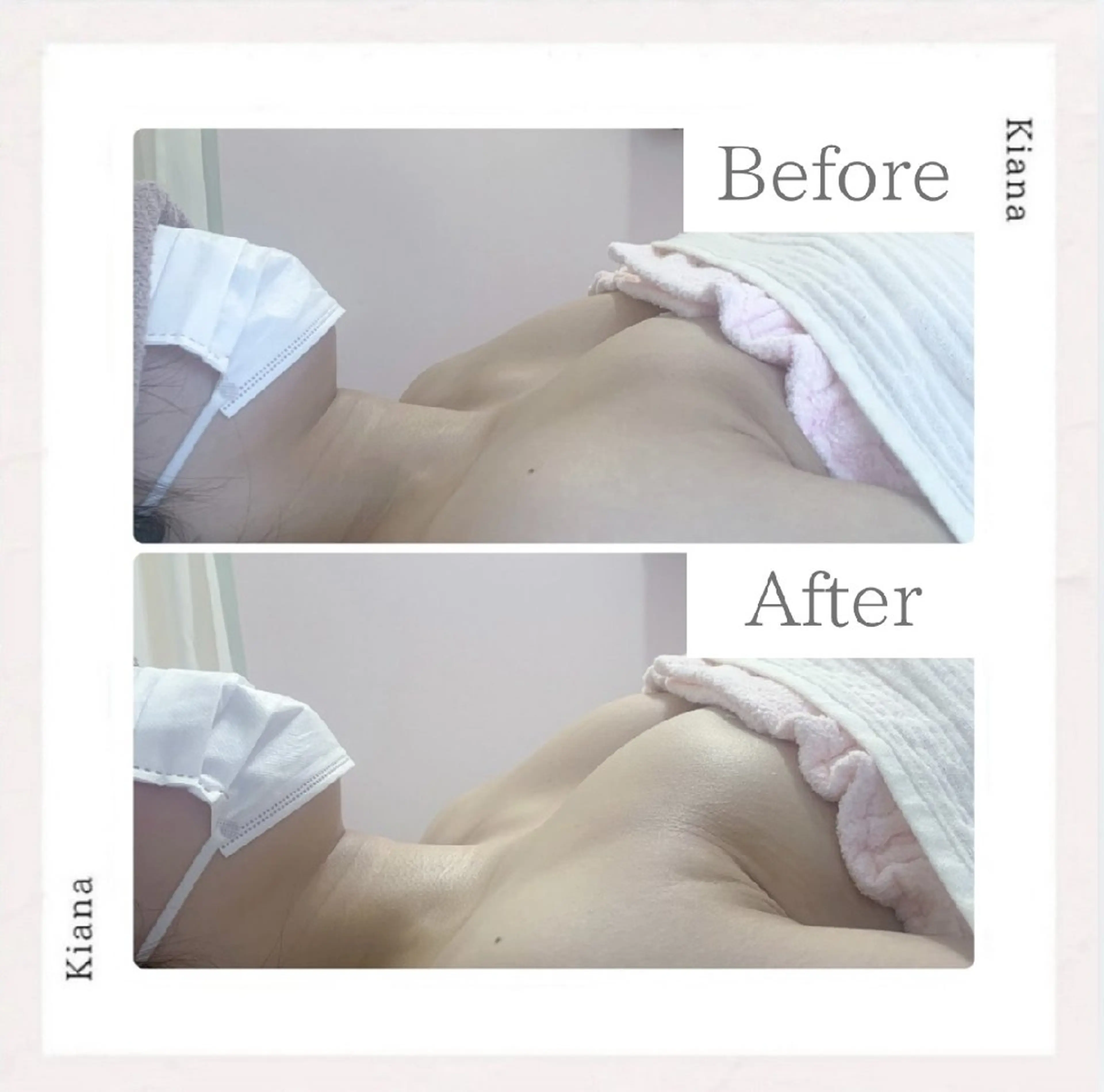 エステ リラク 【バスト専門店 】 Kiana のエステ・リラクイメージ