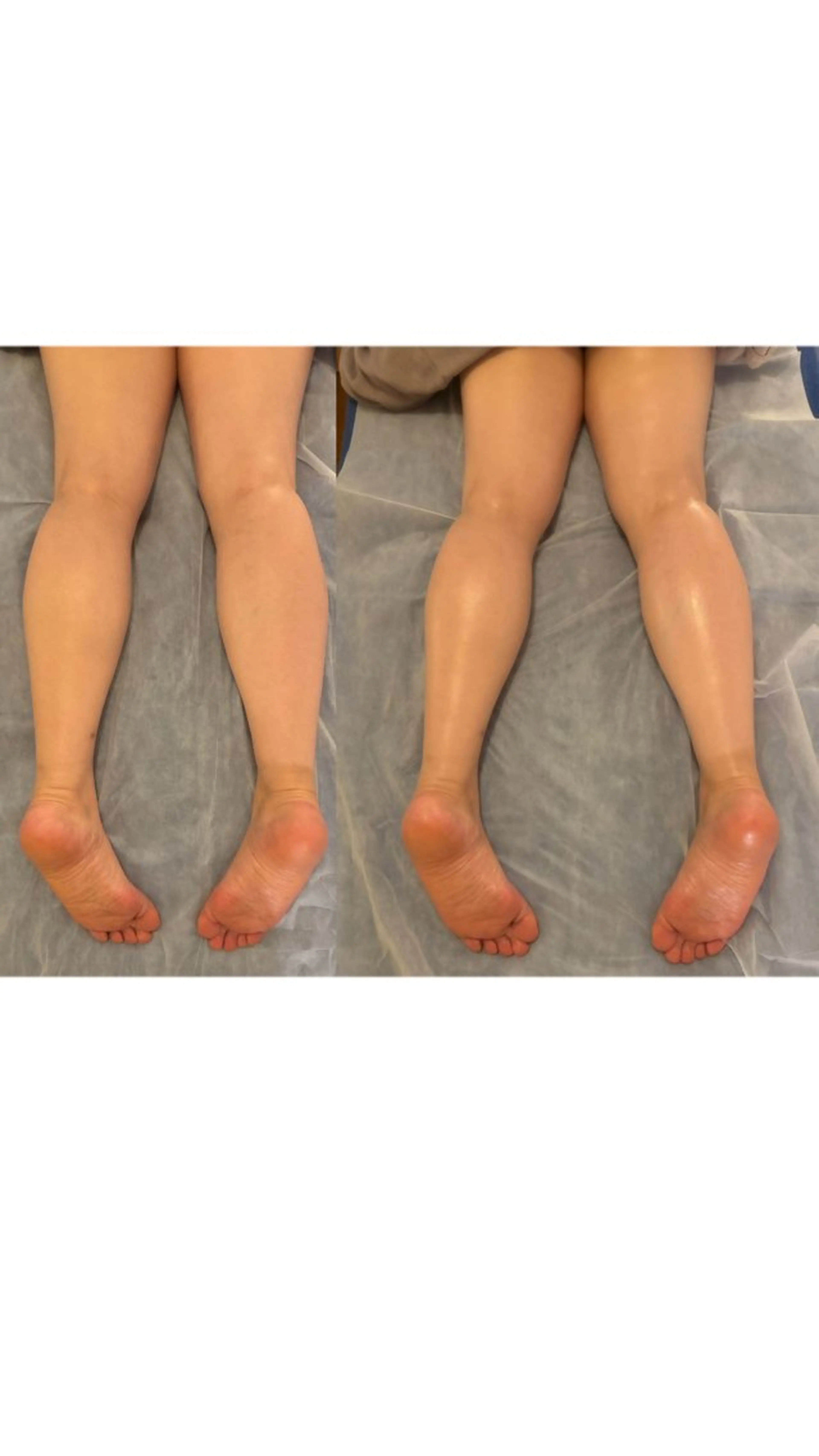 クリスタルでふわふわボディー/オイルコース（全身コース）紙ショーツ、紙ブラ着用の写真