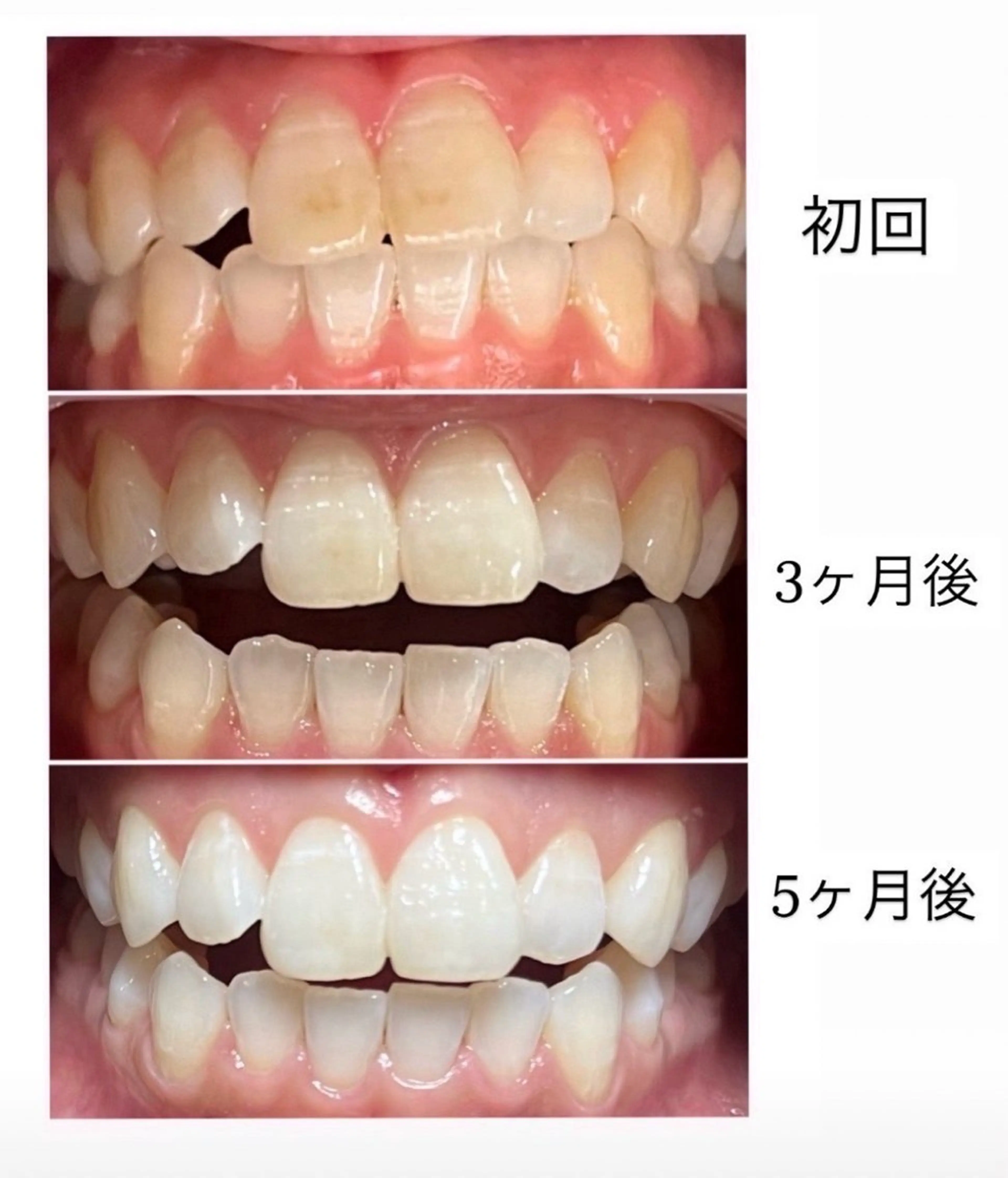ベルーテ エッセンスのエステ・リラクイメージ