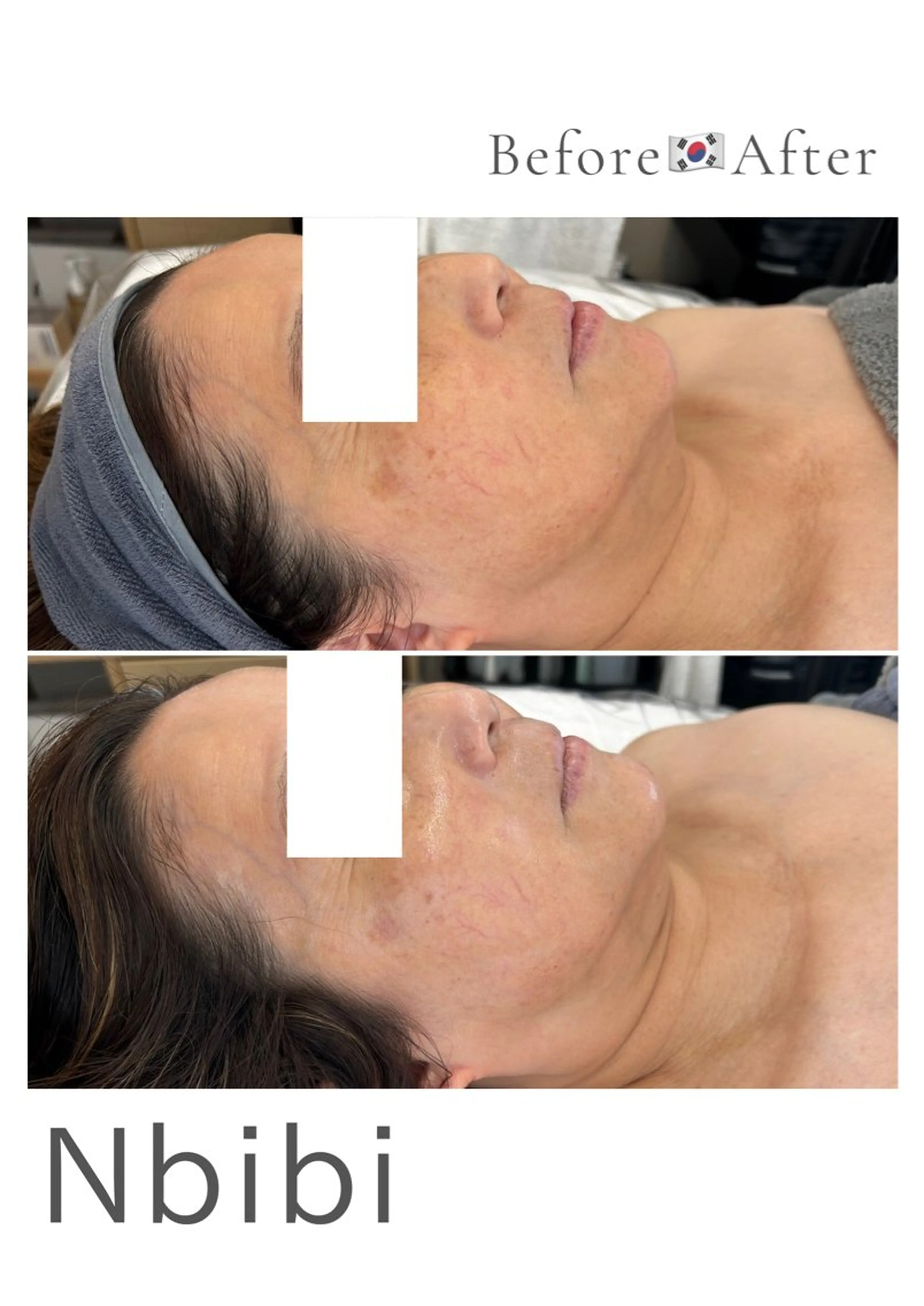 韓国🇰🇷価格 サロン_Nbibiのエステ・リラクイメージ