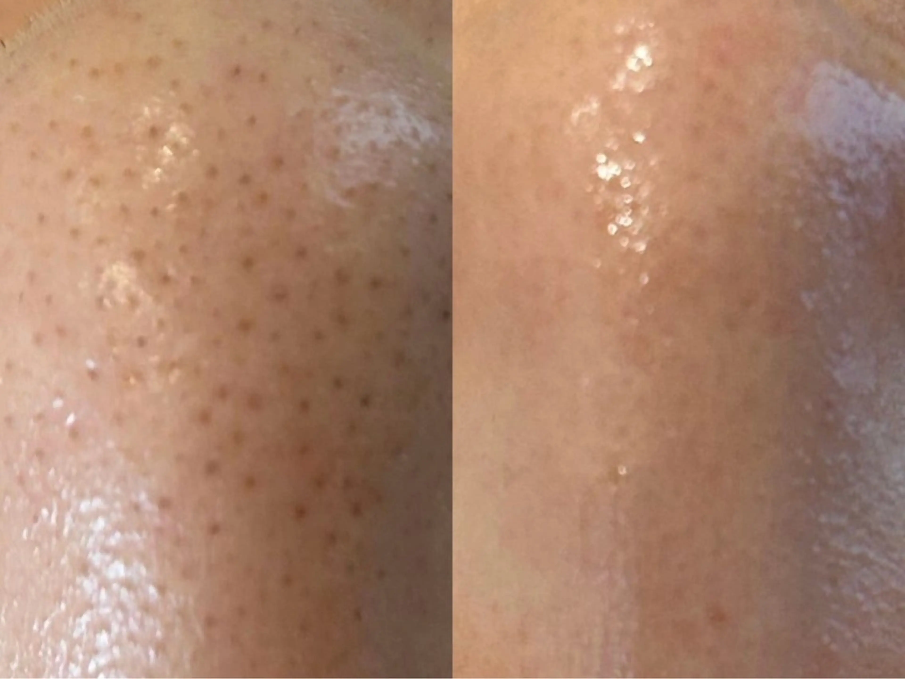 【都度払い脱毛 美肌脱毛】馬車道店のエステ・リラクイメージ