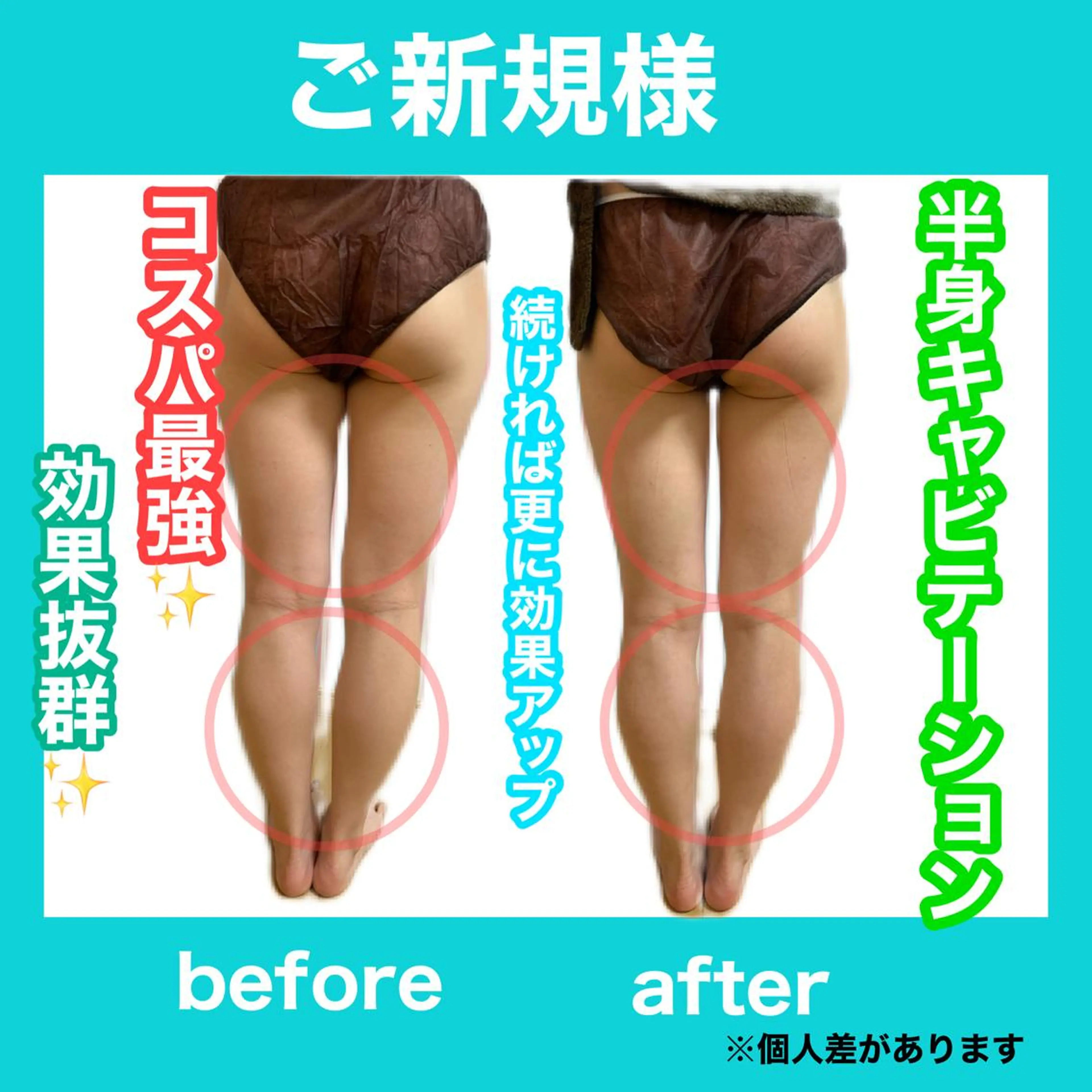 エステ リラク 痩身/脱毛/ネイル HARUKAのエステ・リラクイメージ