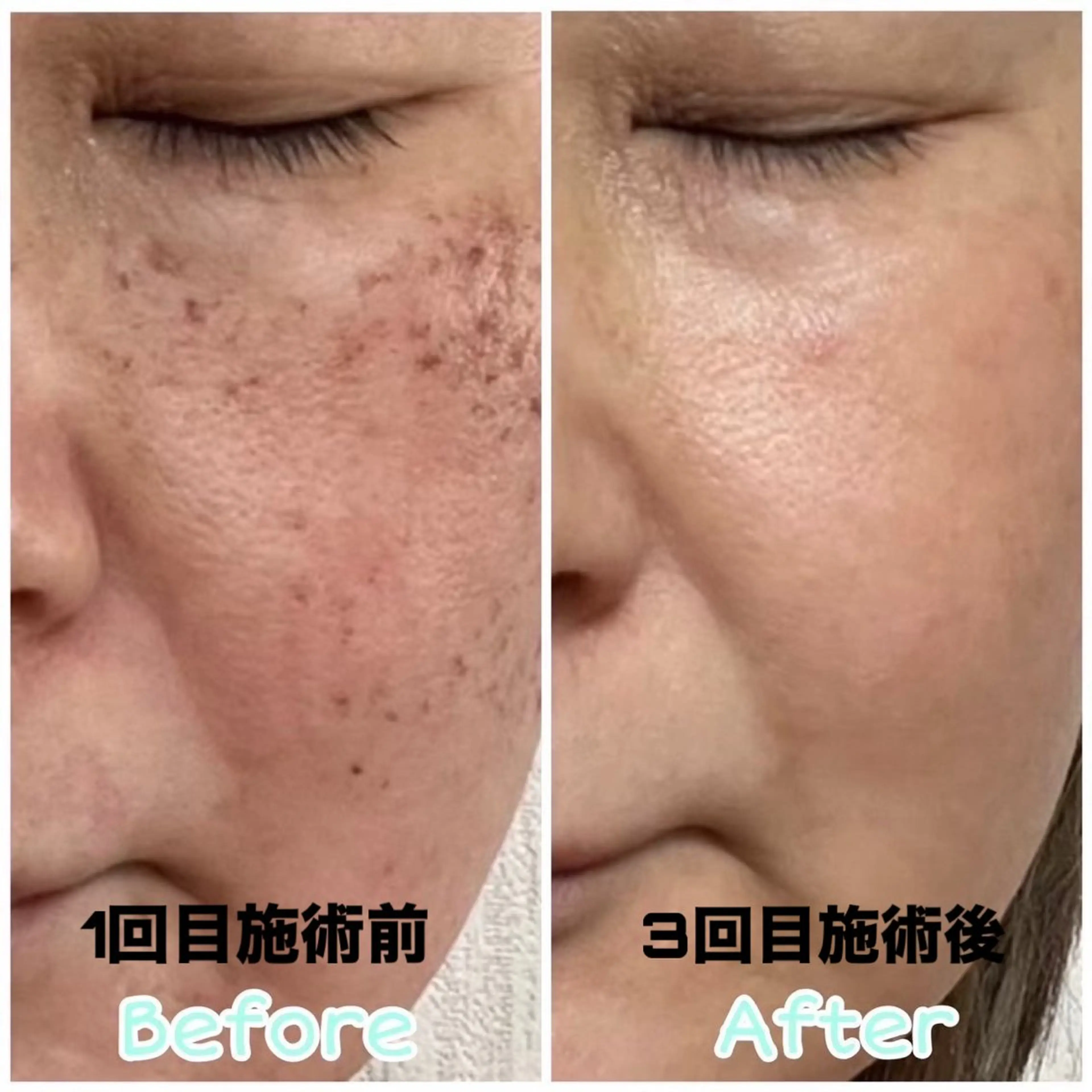 スリーエスプラス内　美肌サロンEme所属・希映 -kieのエステ・リラクイメージ