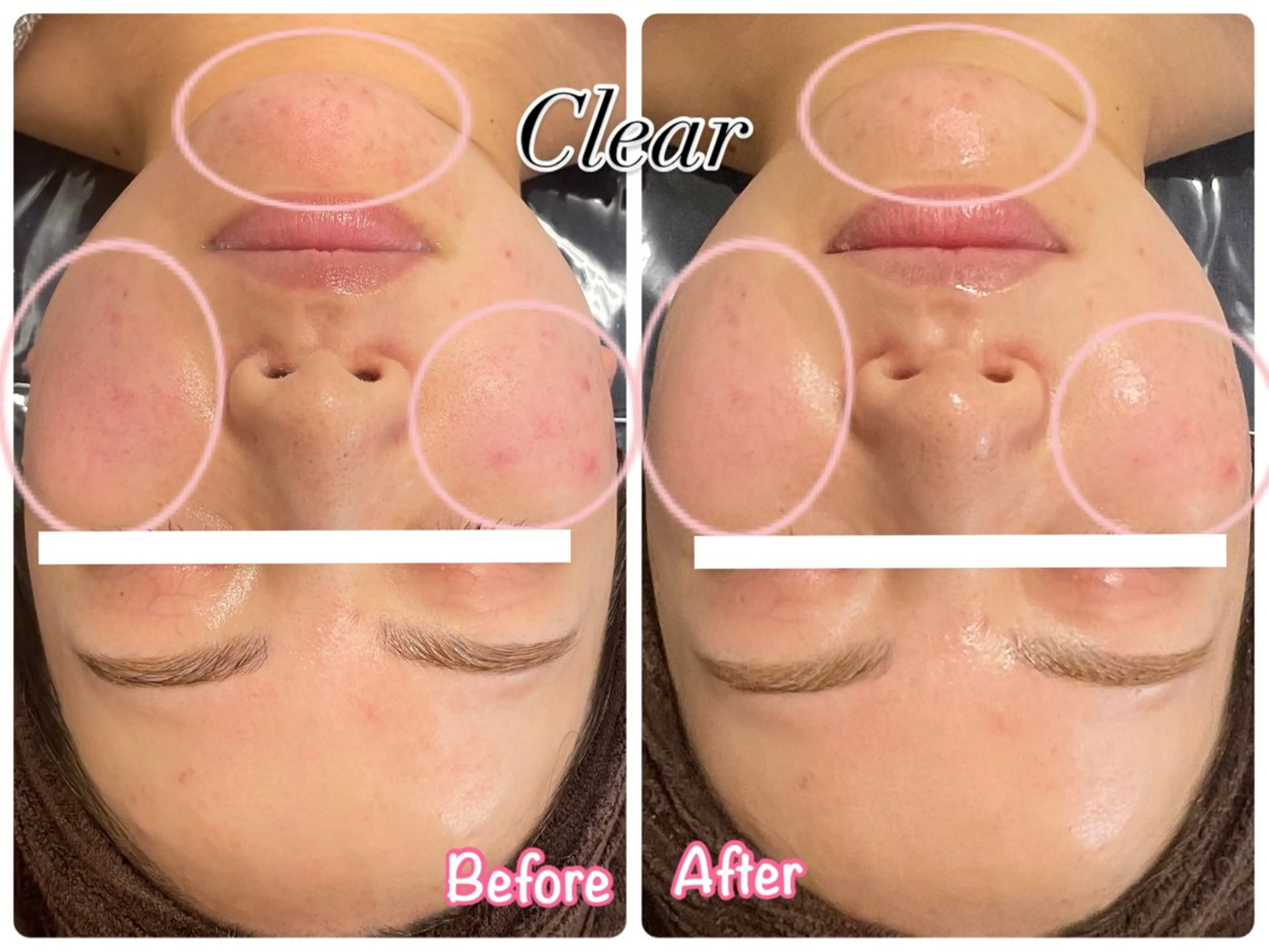 エステ Clear所属・贅沢プライベート サロンClearのエステ・リラクイメージ