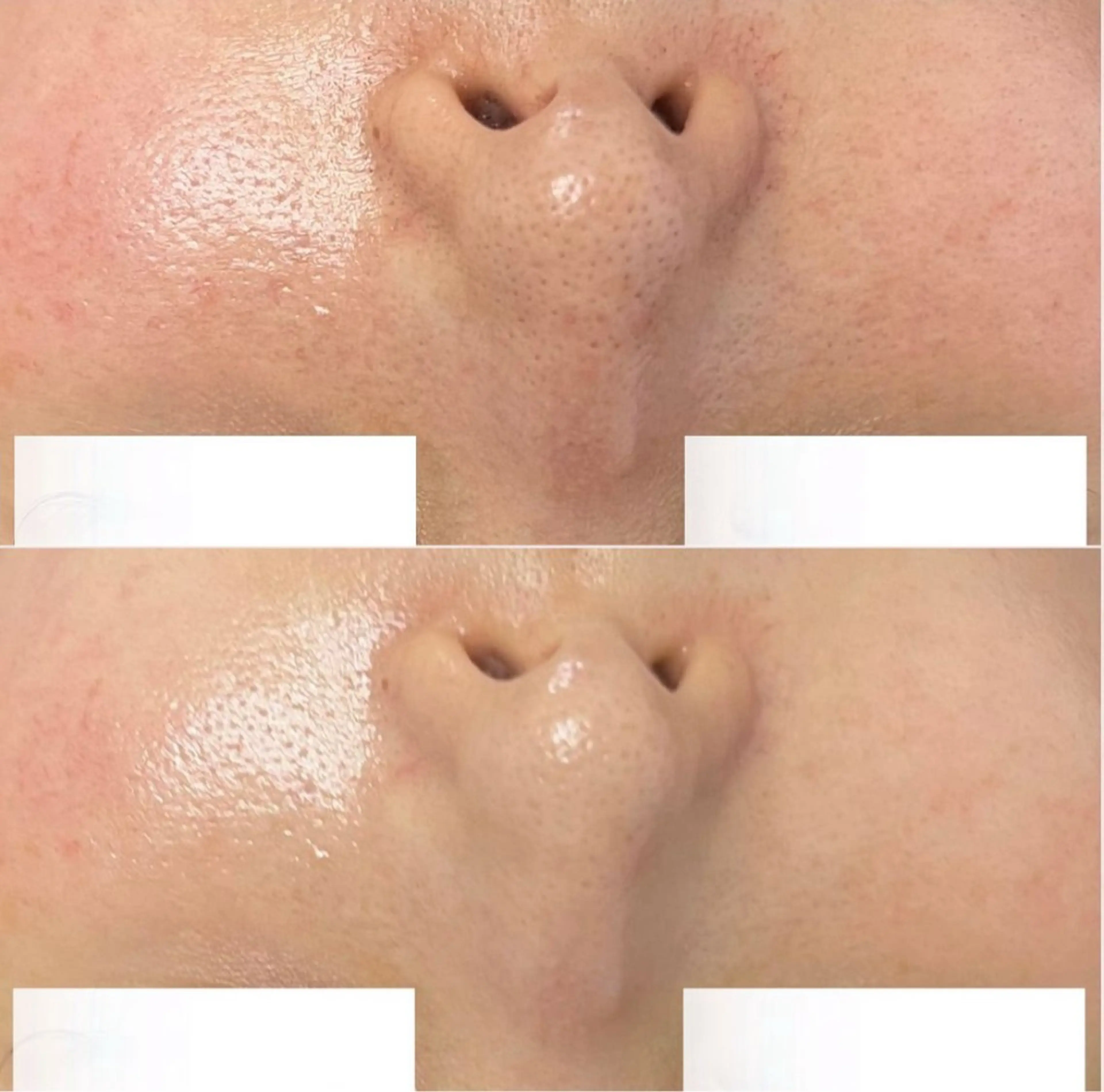 毛穴レス美肌へ🌿 看護師Abe🌼のエステ・リラクイメージ