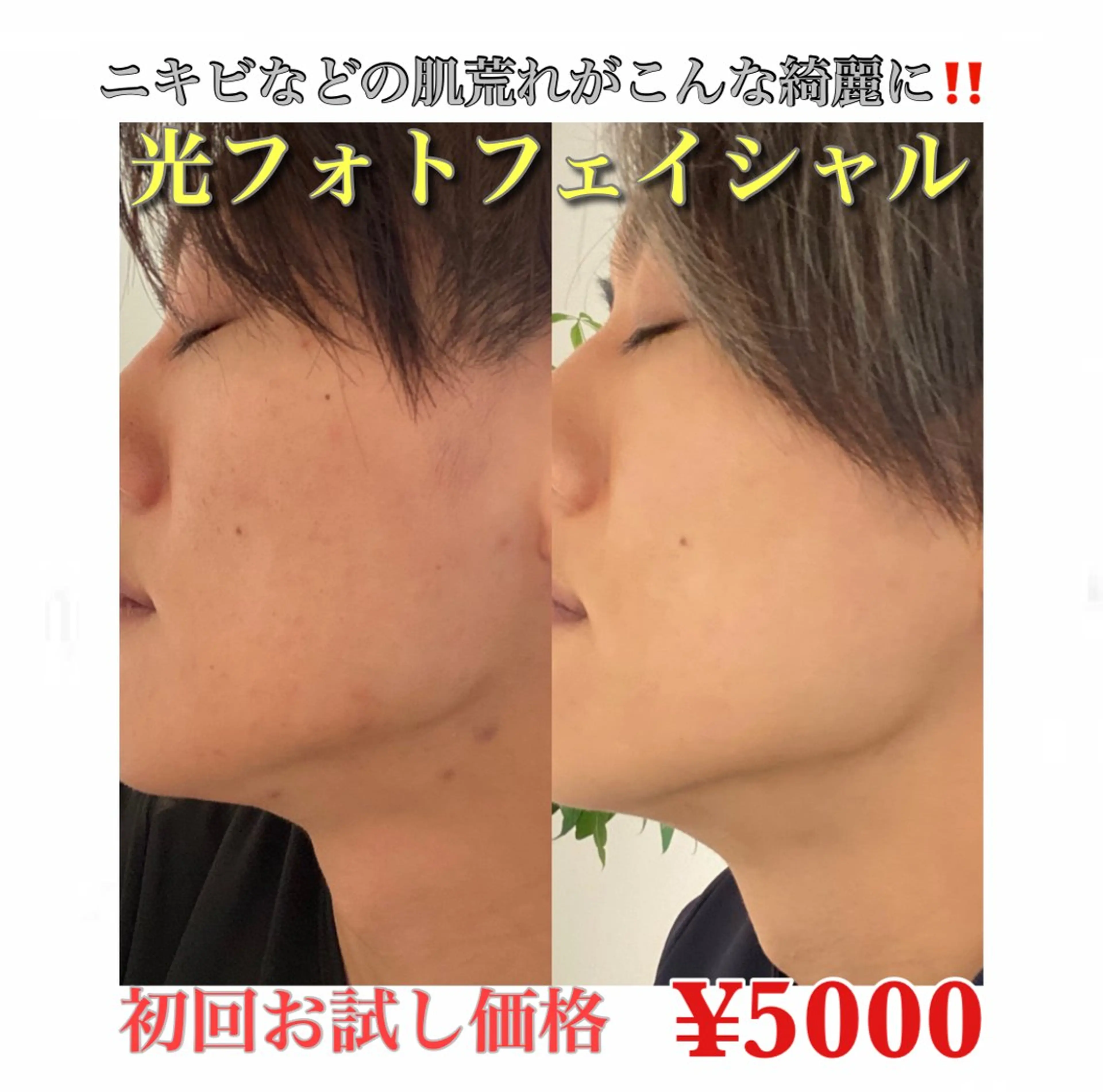 メンズ ビューティーサロン リノア心斎橋店のエステ・リラクイメージ