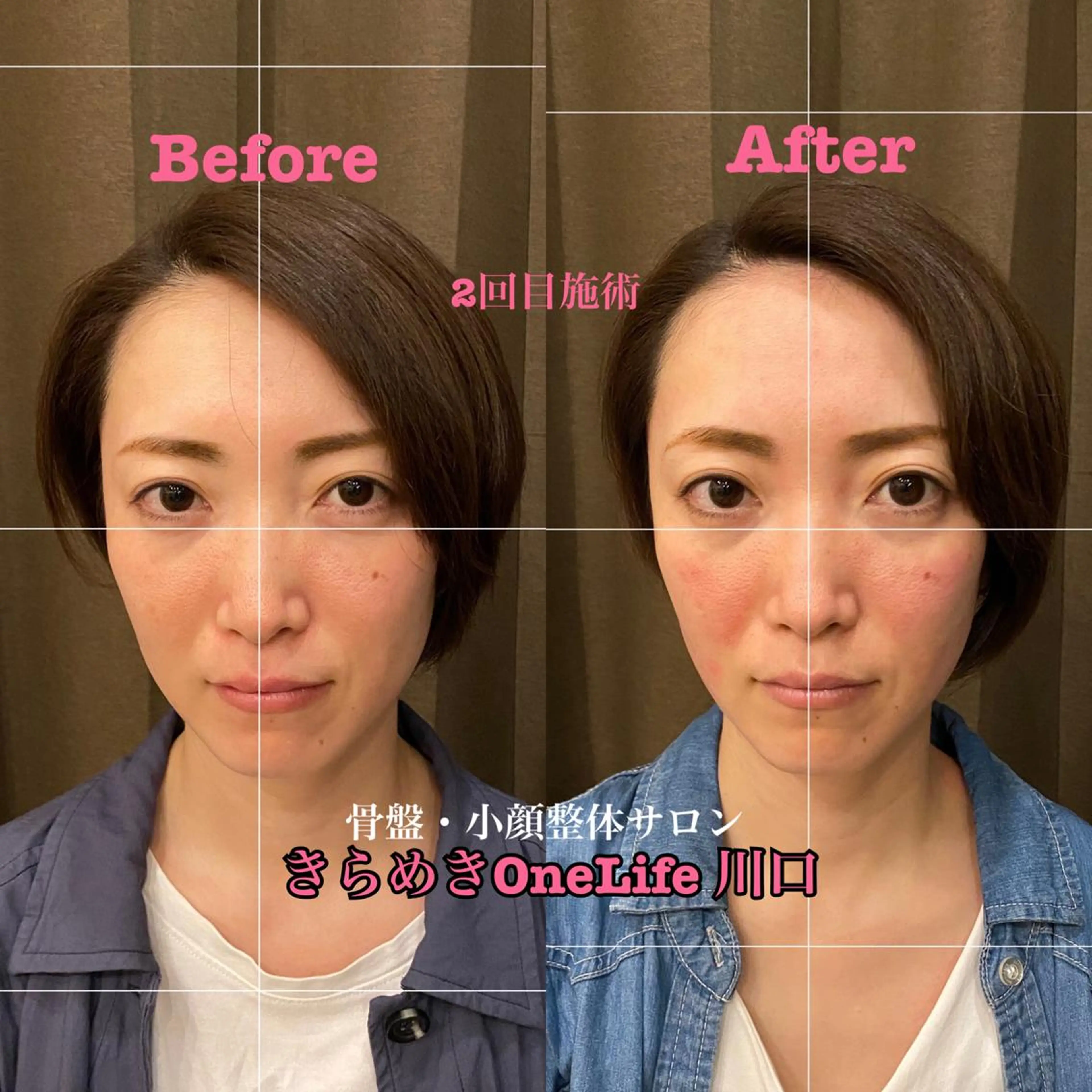 エステ リラク きらめきワンライフ Yumaのエステ・リラクイメージ