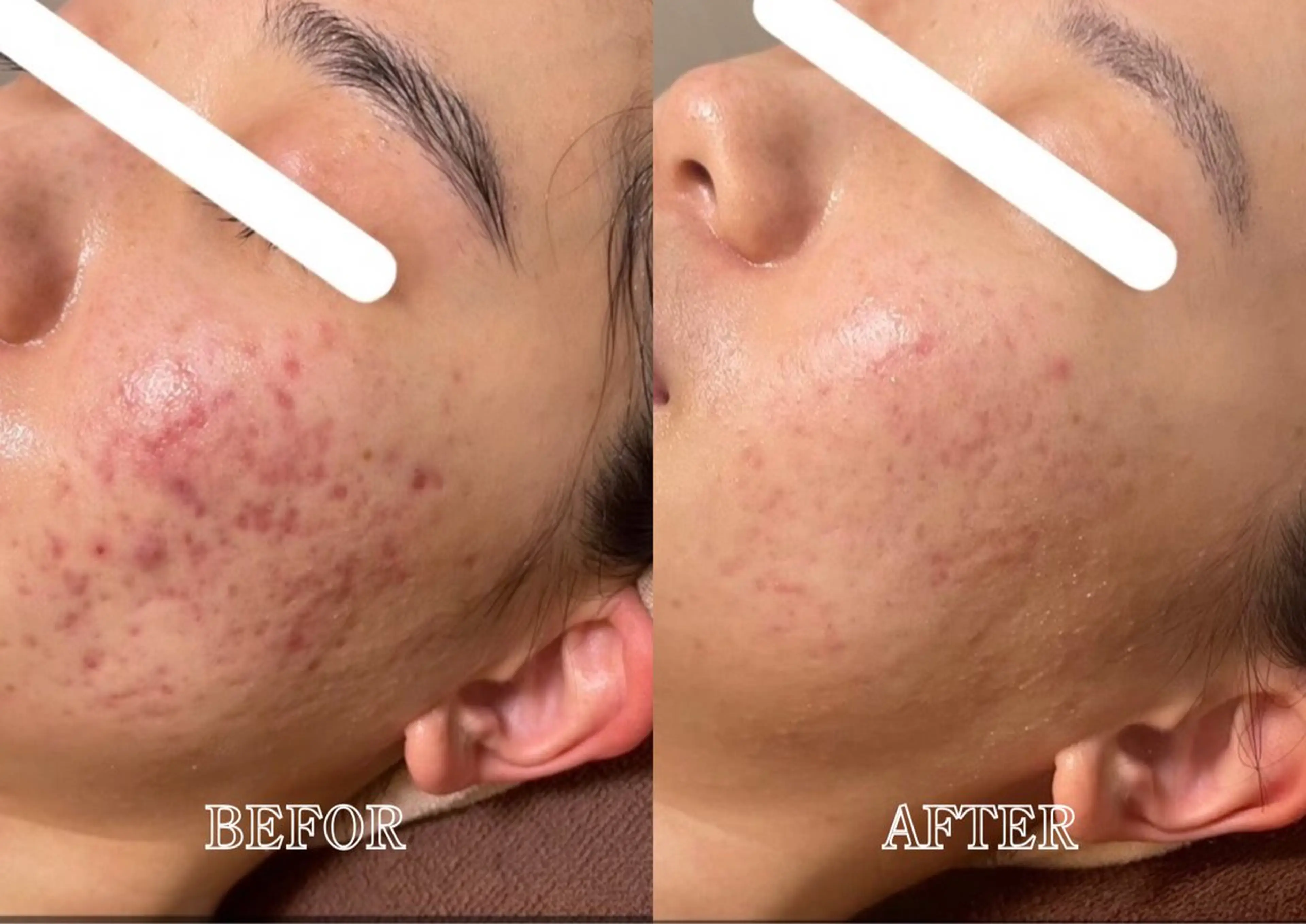 Lys Blancのエステ・リラクイメージ