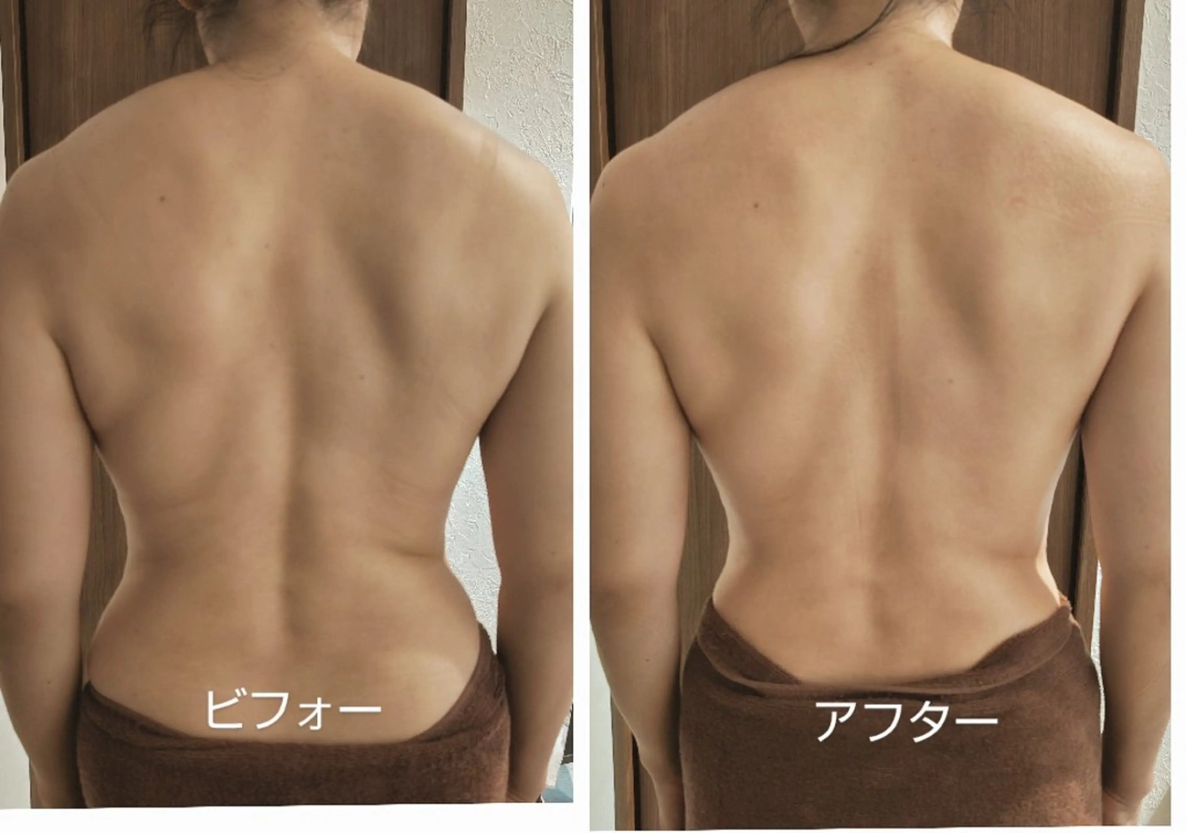 ⭐お試し45分（1​〜​2部位）⭐の写真