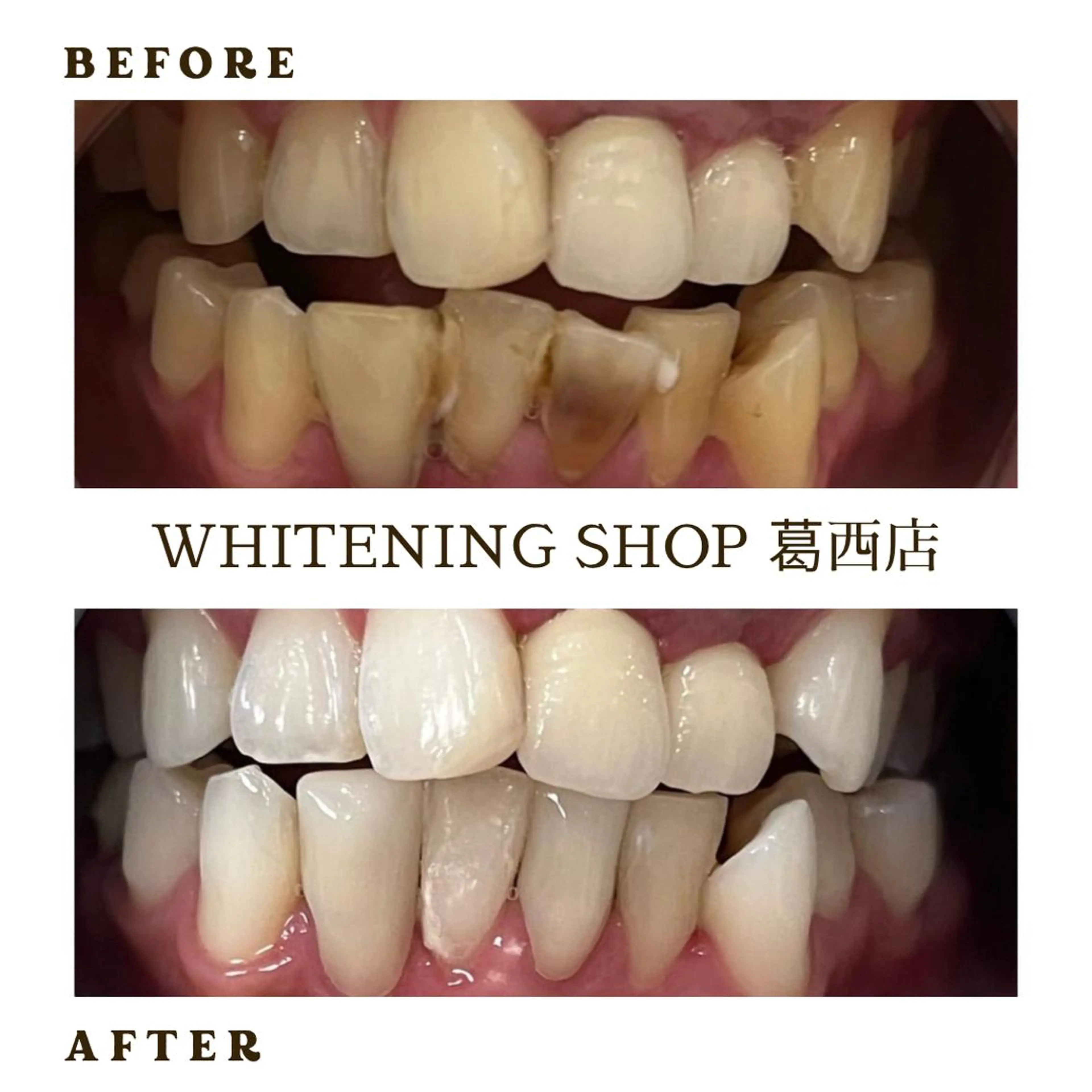 メンズ その他 ホワイトニング ショップ葛西店のその他イメージ