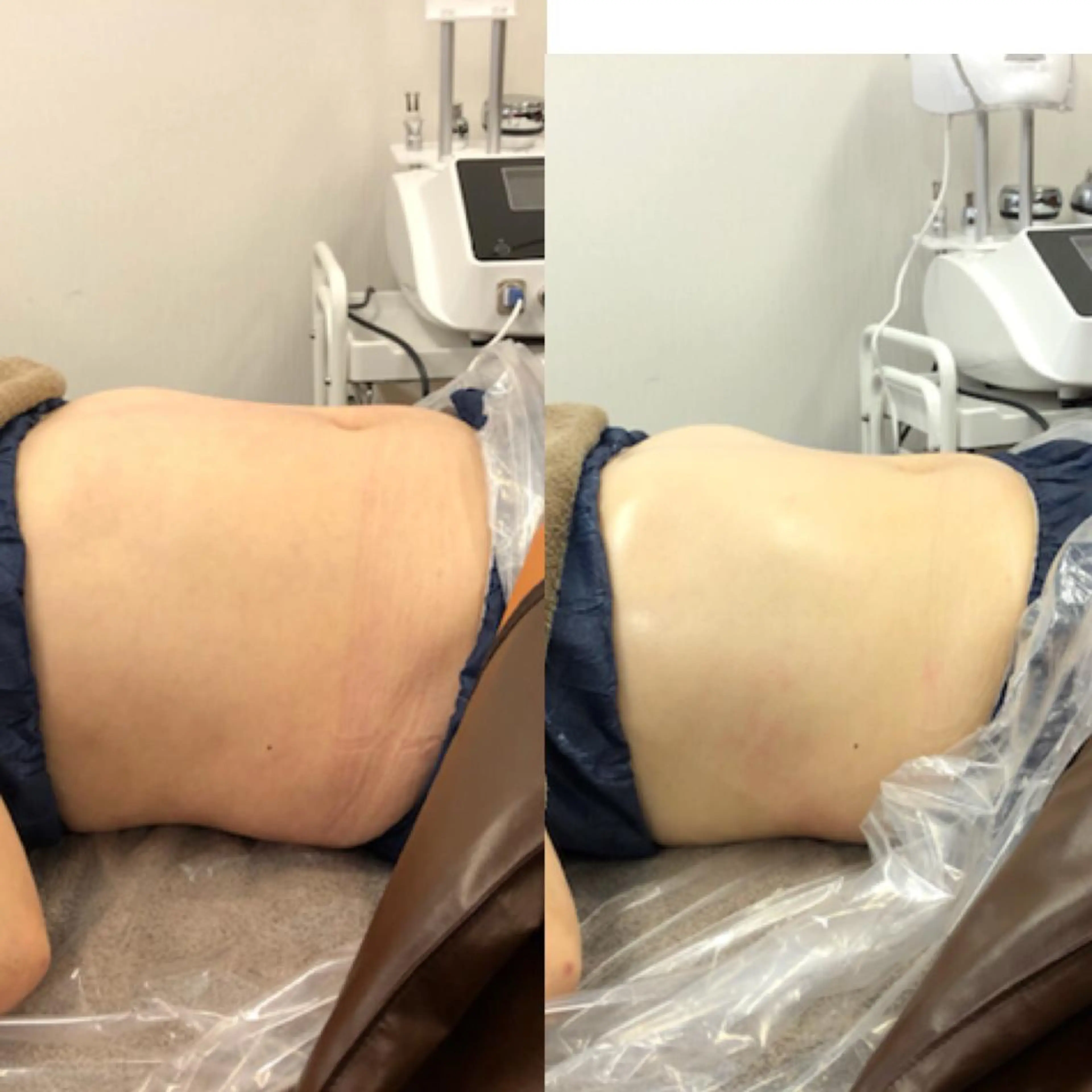 ベルデ106 verde106のエステ・リラクイメージ