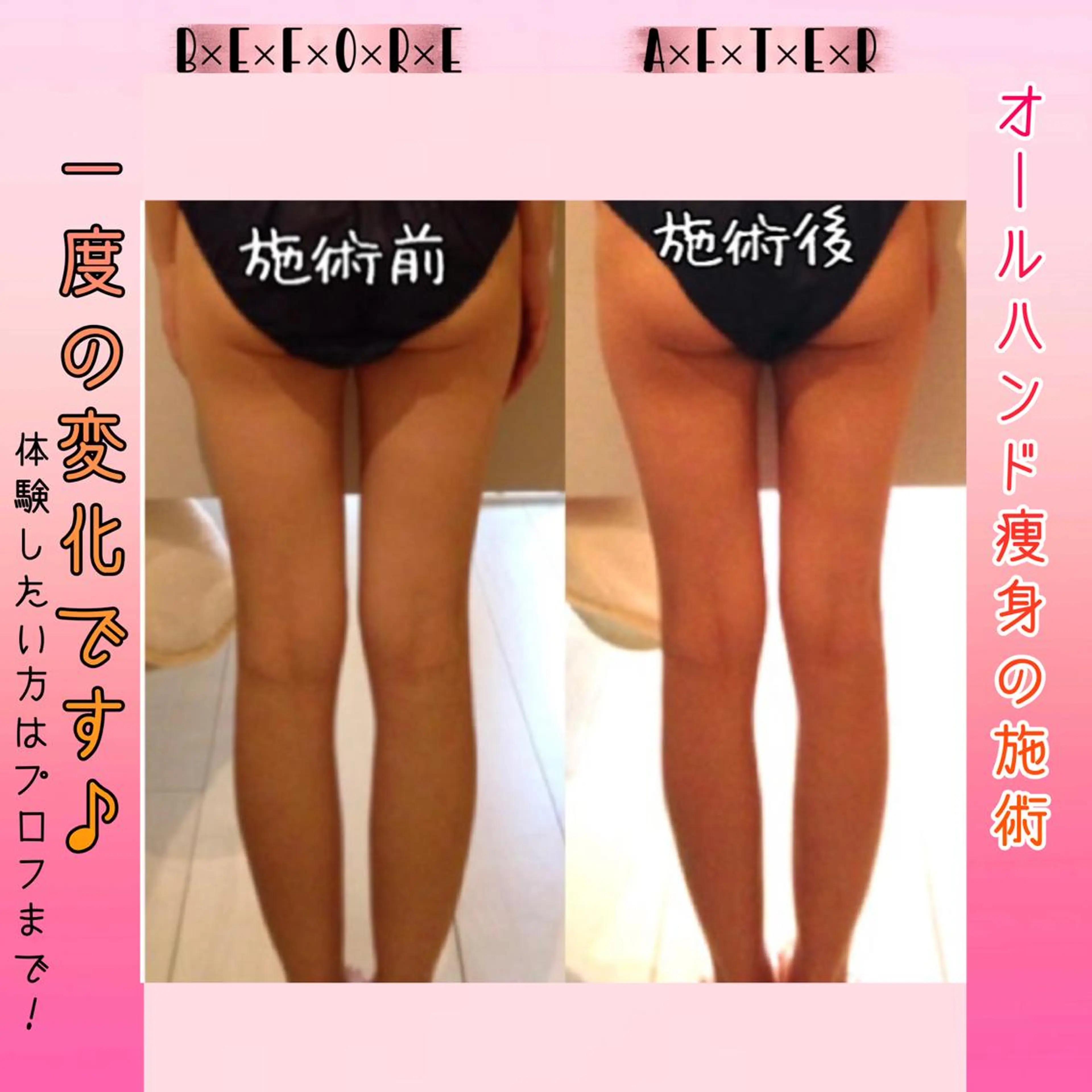 ミディアム カラー パーマ ヘアアレンジ メンズ キッズ ネイル マツエク・マツパ アイブロウ 結婚式・ブライダル 結婚式・ブライダル 小顔カット トリートメント ブライダルネイル 強圧オールハンド痩身&黄土よもぎ蒸しプライベートサロンClematis池袋所属・強圧オールハンド痩身 片野のエステ・リラクイメージ