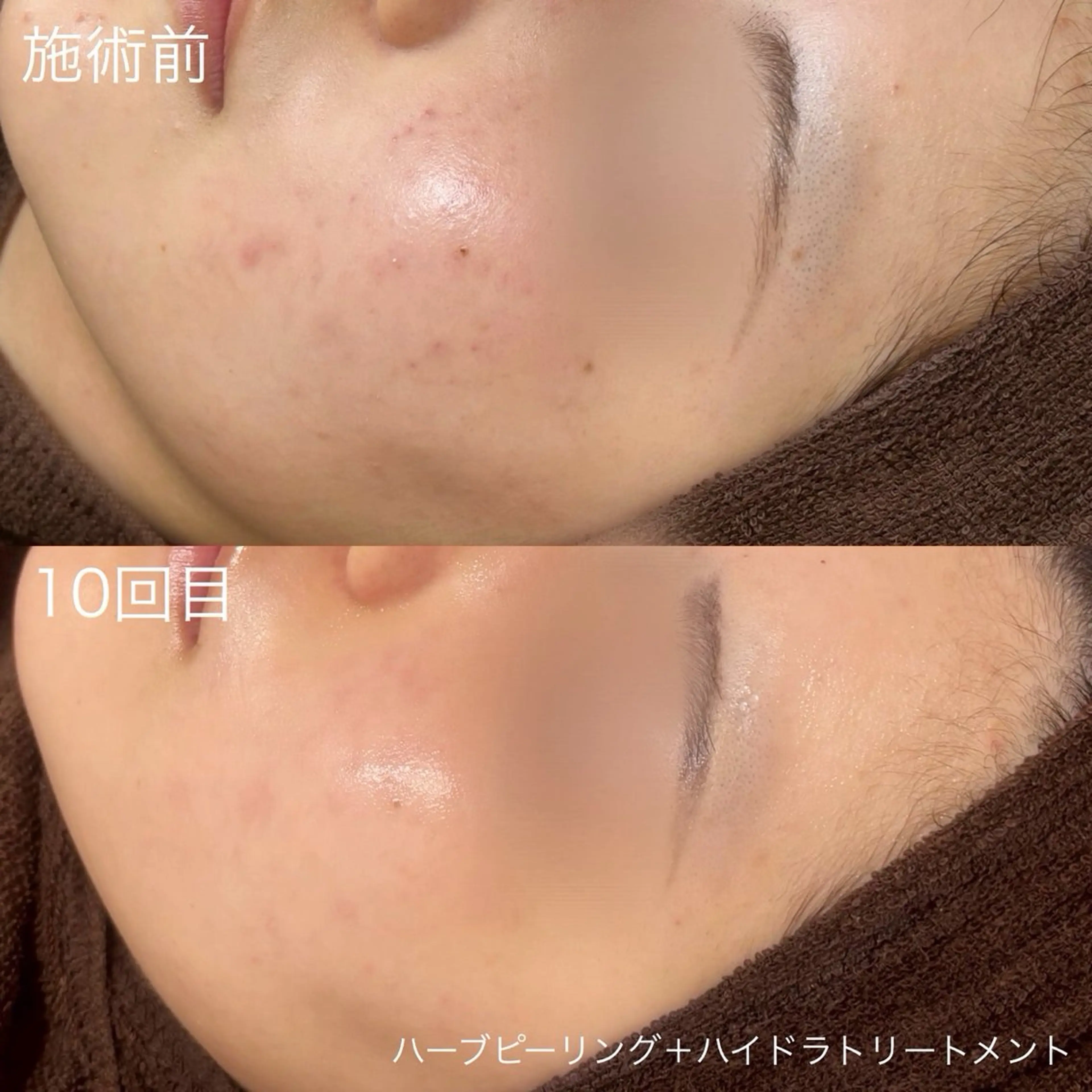 脱毛 lulula ricoのエステ・リラクイメージ