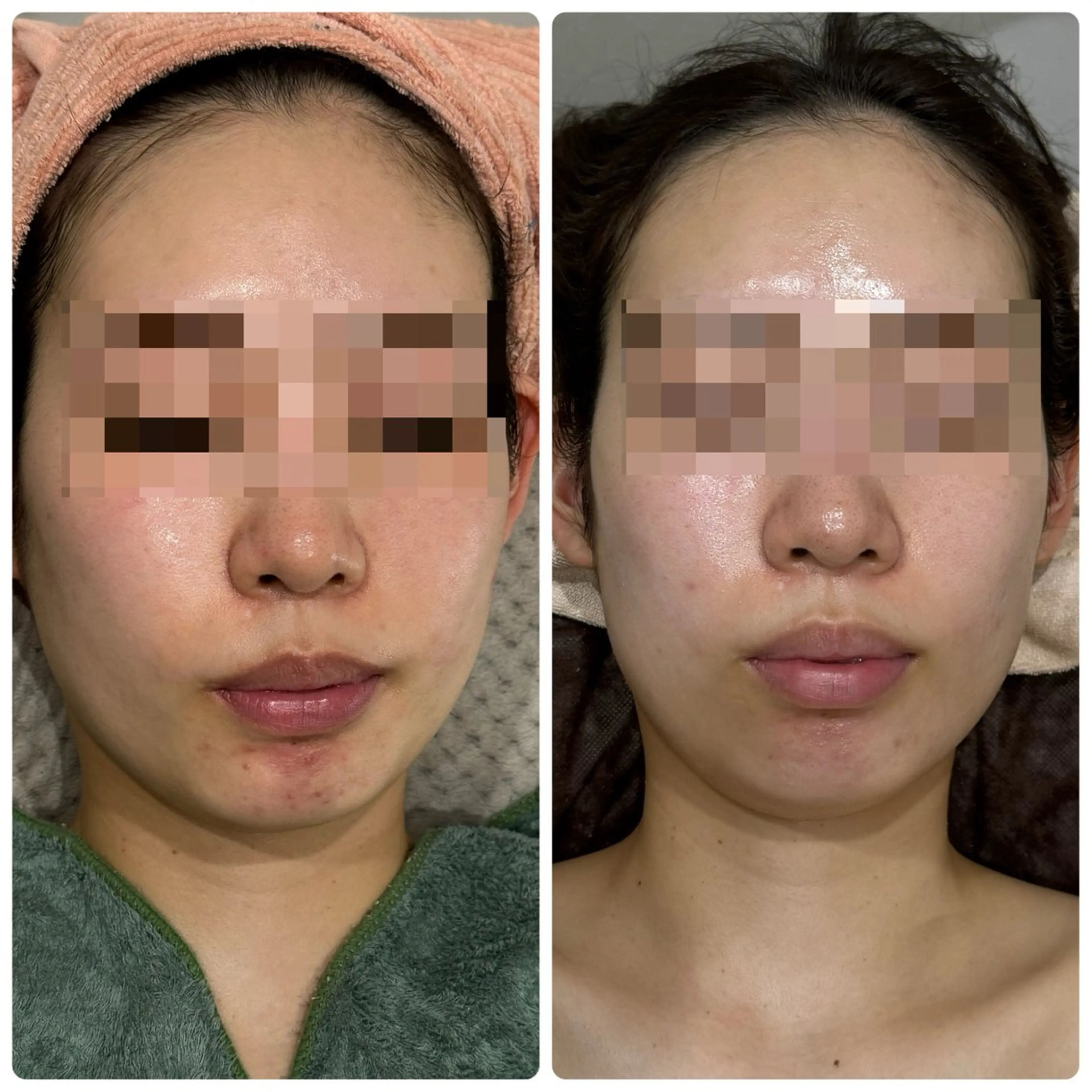 エステ 脱毛&フェイシャル 専門店muro.のエステ・リラクイメージ