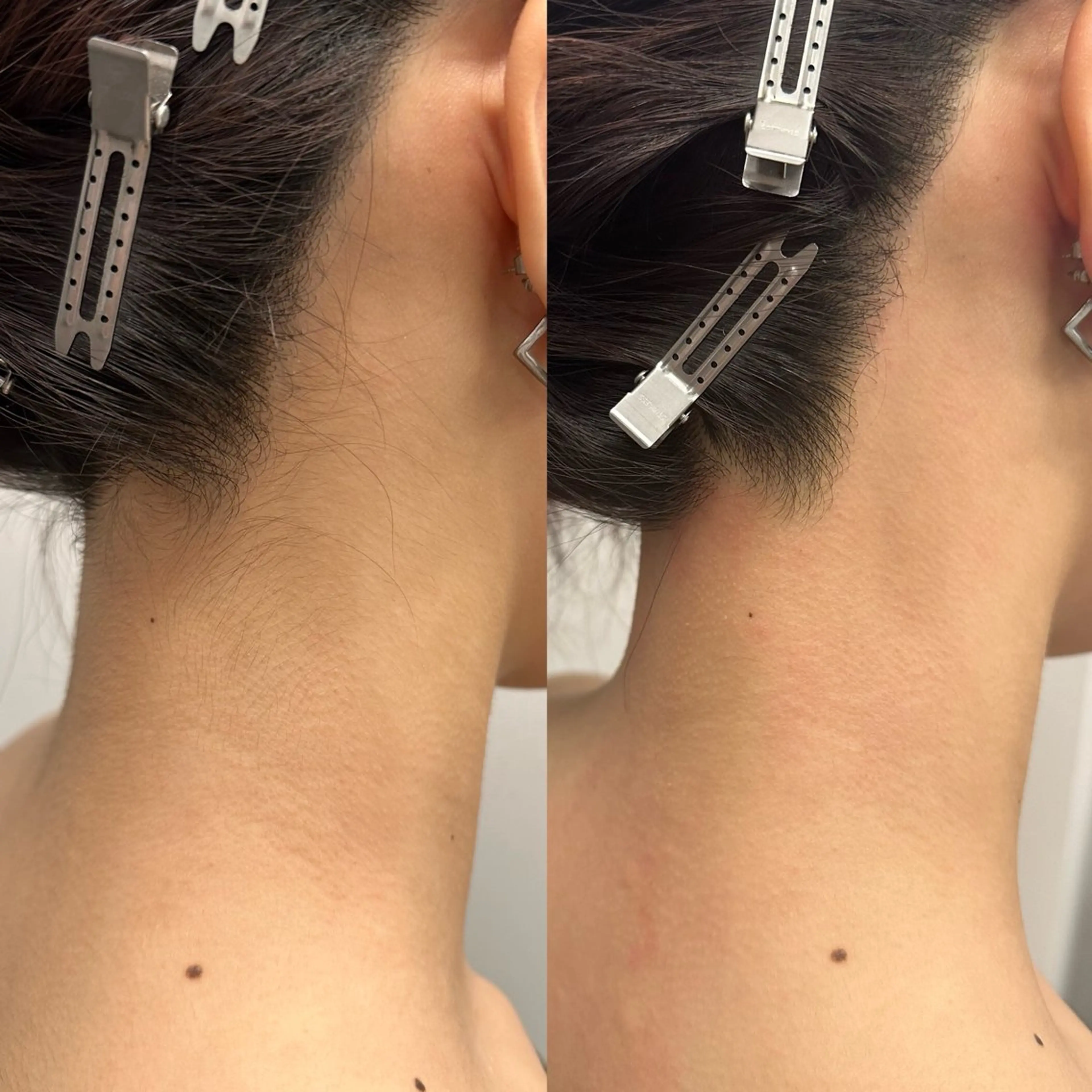 脱毛 🦋美肌サロン. maho🦋のエステ・リラクイメージ