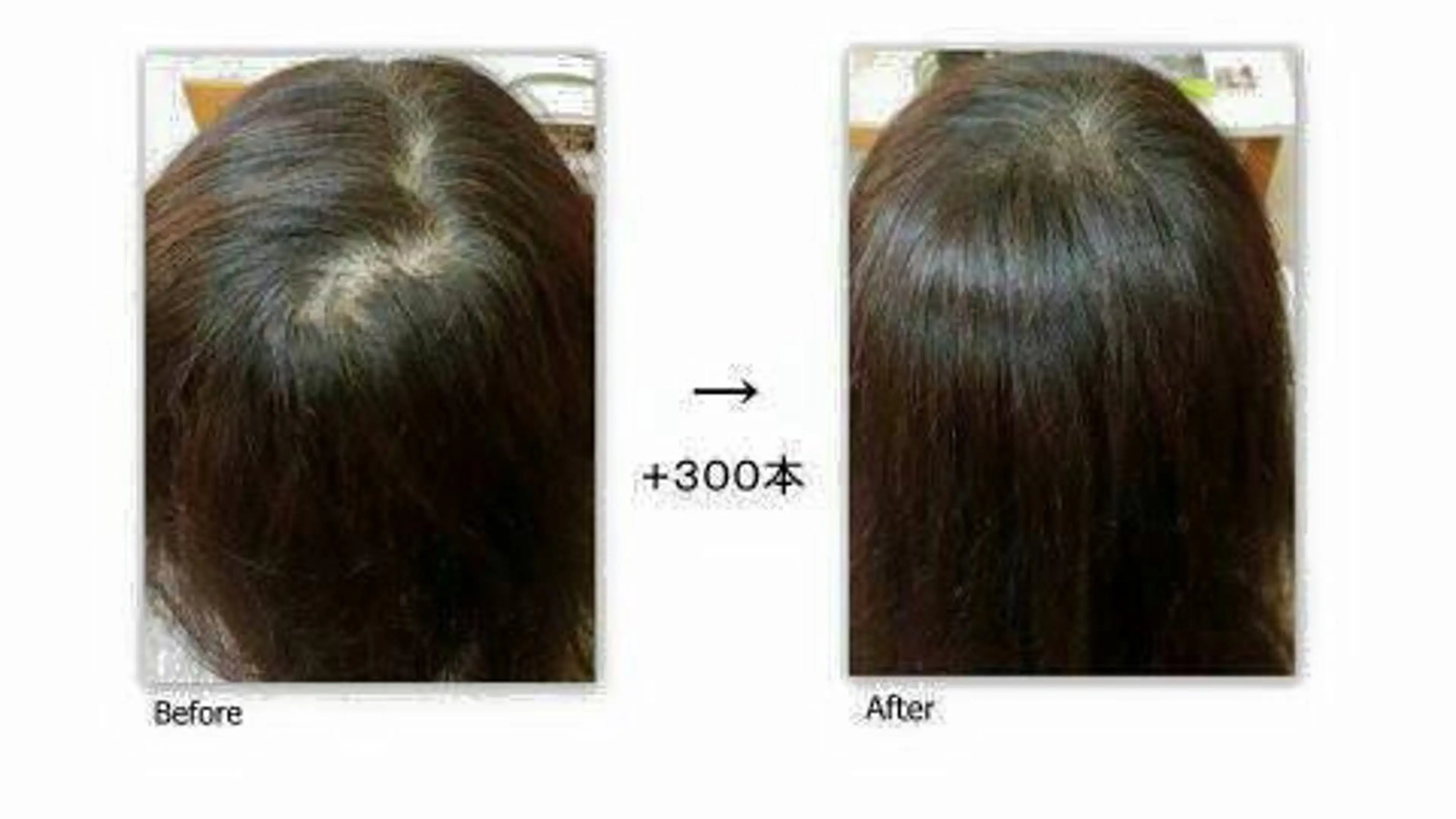 【痩身▪️体質改善ダイエット】美養サロンEnbi~縁美~所属・美養サロンEnbi ~縁美~のエステ・リラクイメージ