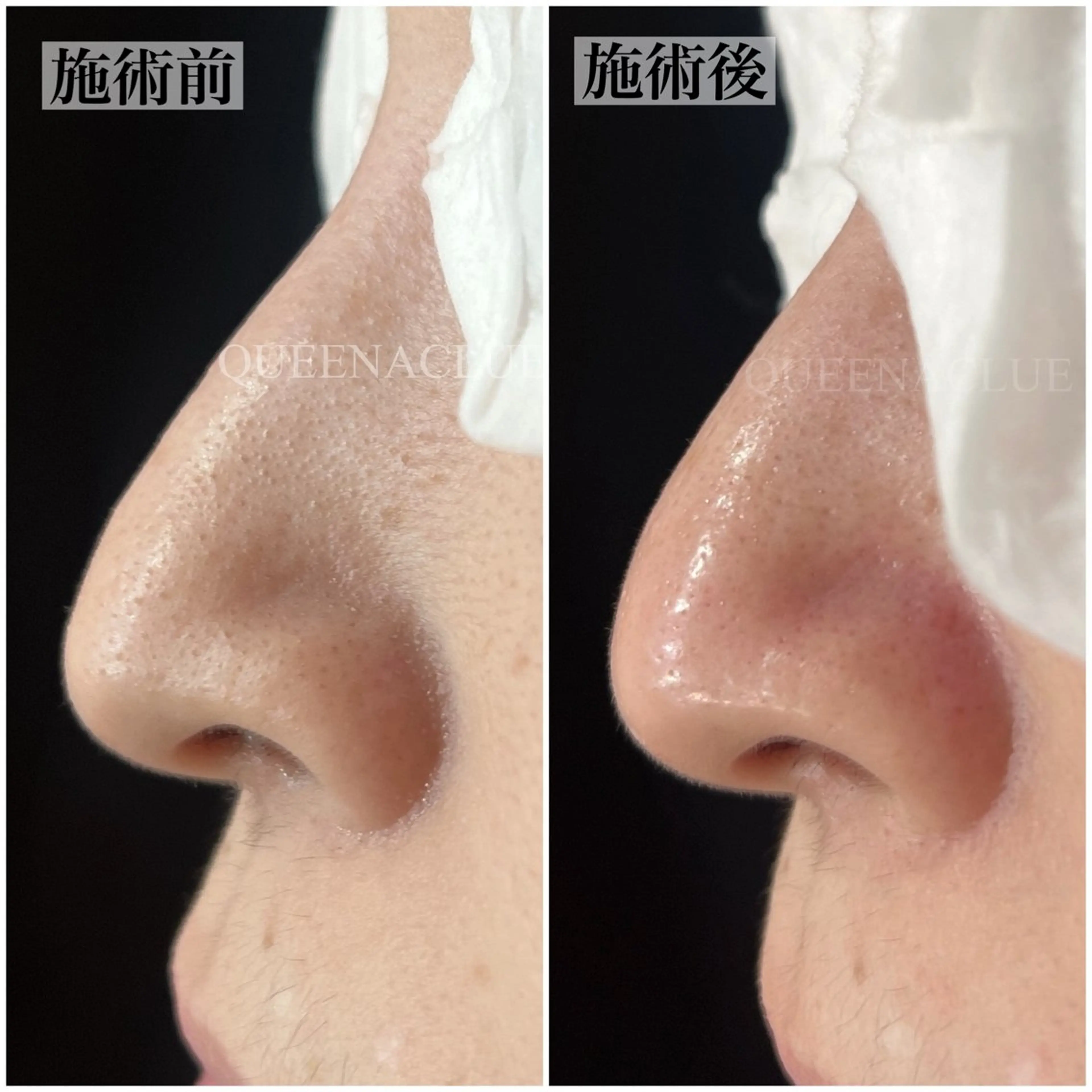 毛穴改善/脱毛 ネイル 川上久仁子のエステ・リラクイメージ