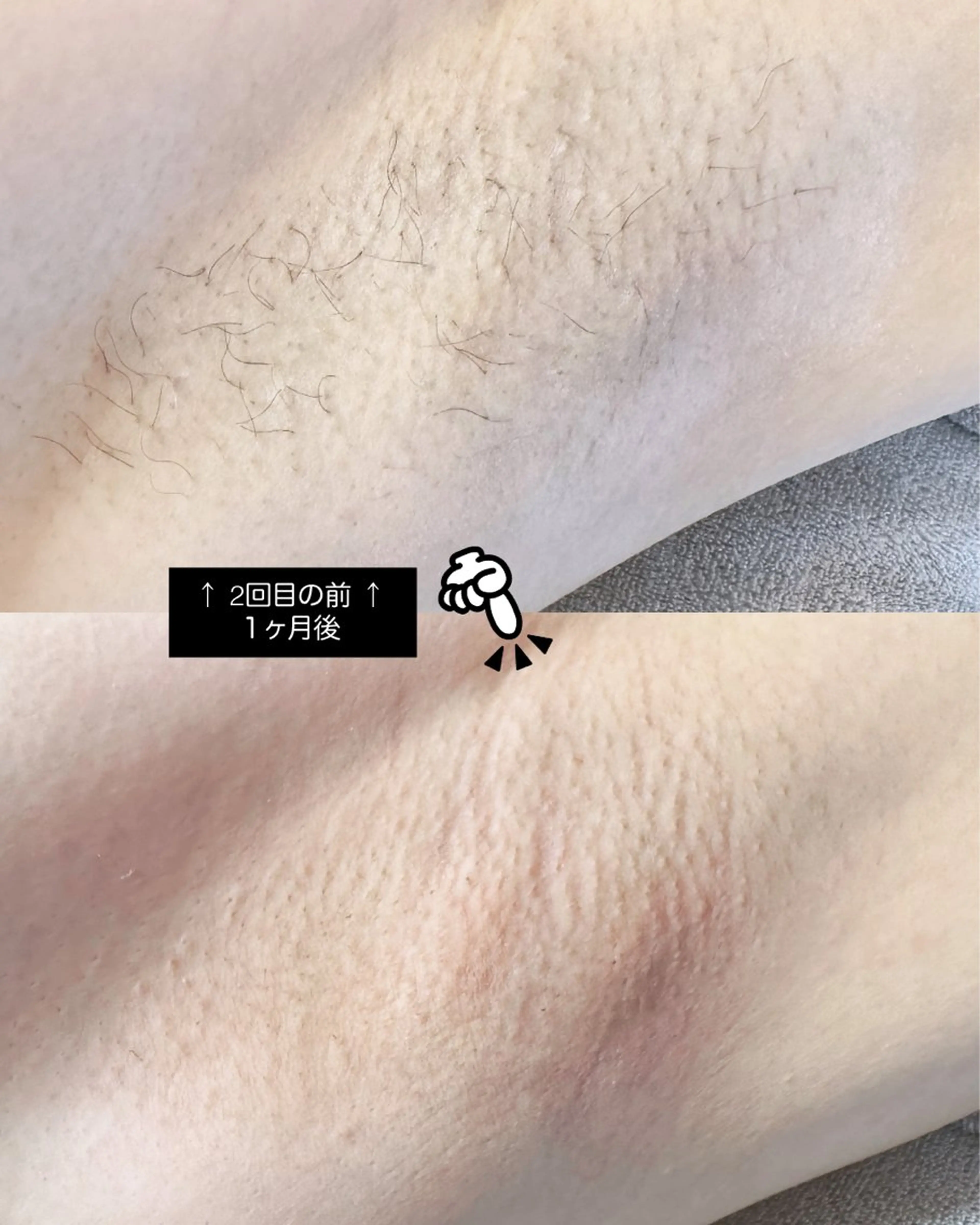 Hit. シュガーリング豊橋のエステ・リラクイメージ