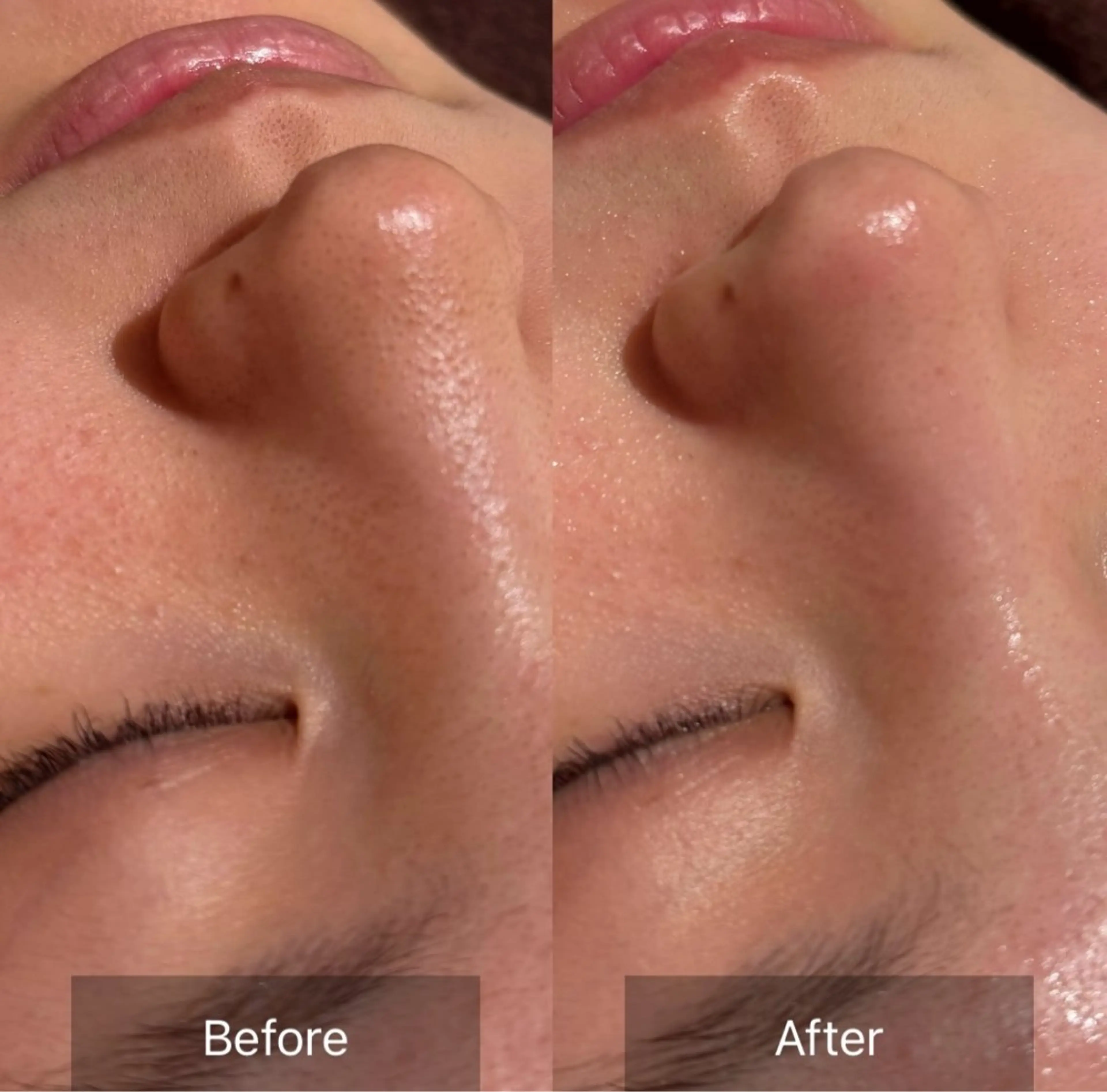 その他 for woman所属・森 美優のエステ・リラクイメージ