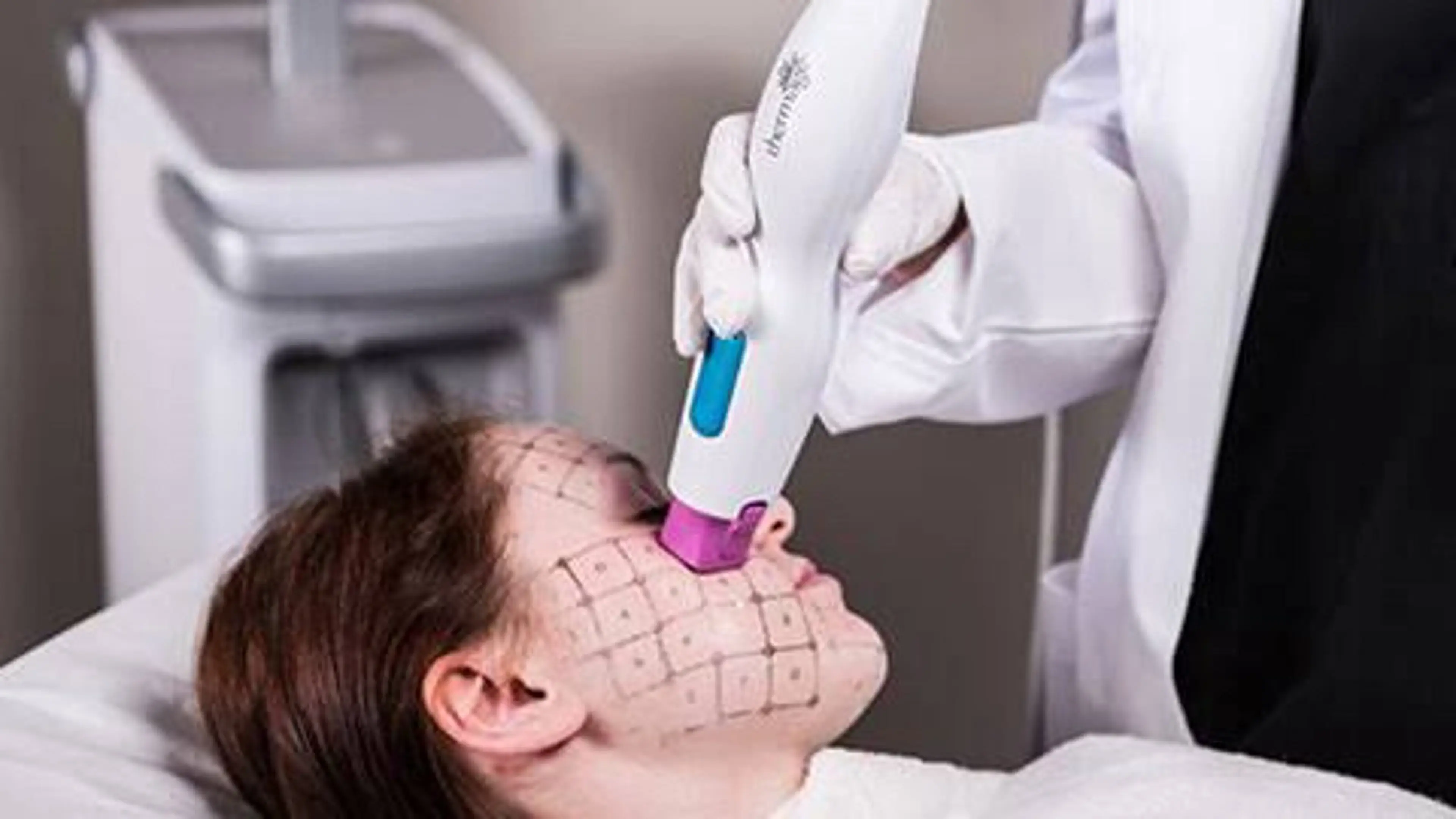 【ほうれい線撃退】サーマクールマシーン＋パック導入EMS（デコルテマッサージ付き）の写真