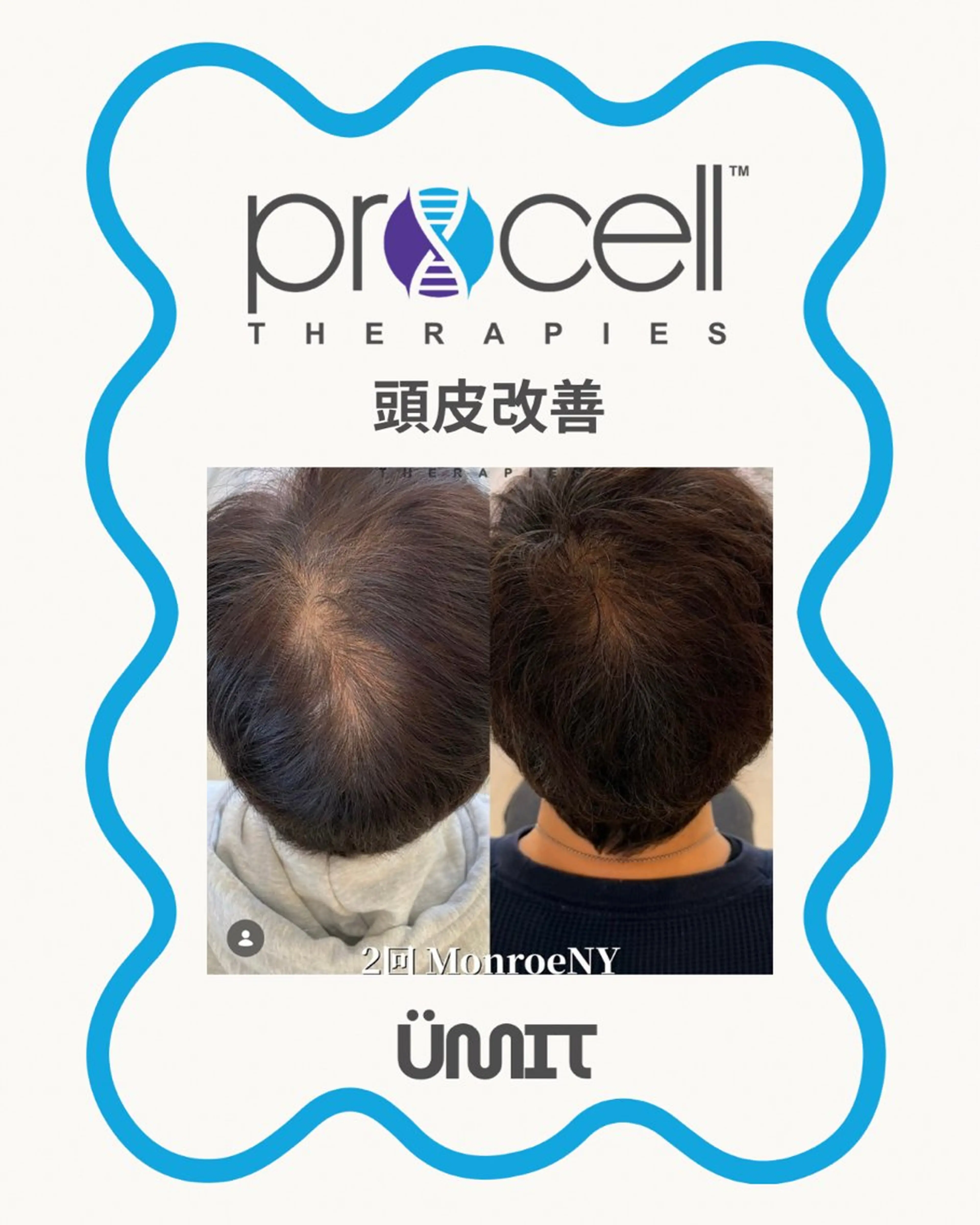 メンズ ヘッドスパ Ümit（ユミト） プロセルセラピーズのネイルデザイン