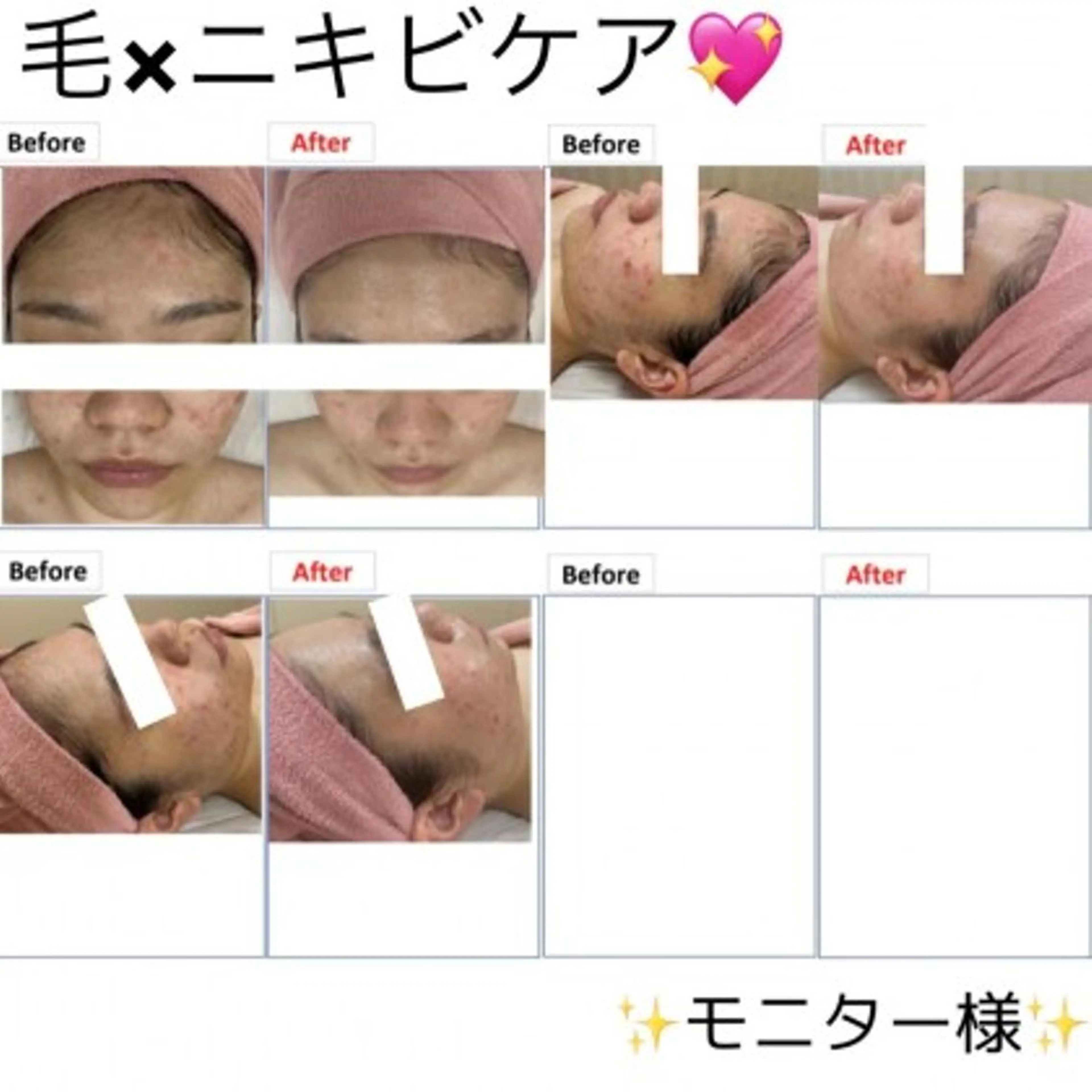 トータル美容 RAYVIS札幌店のエステ・リラクイメージ