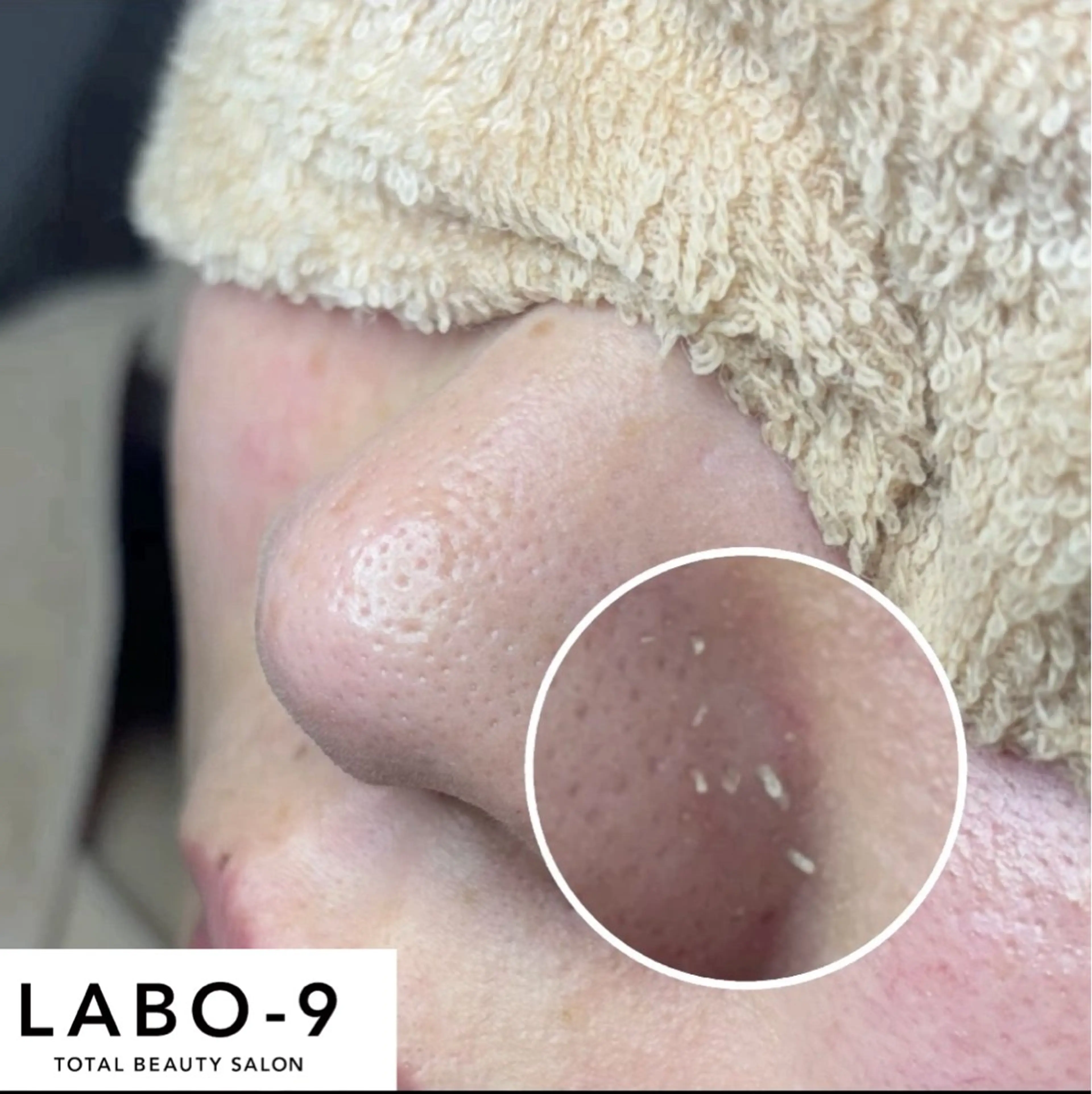 エステ LABO-9所属・田中 捺未のエステ・リラクイメージ