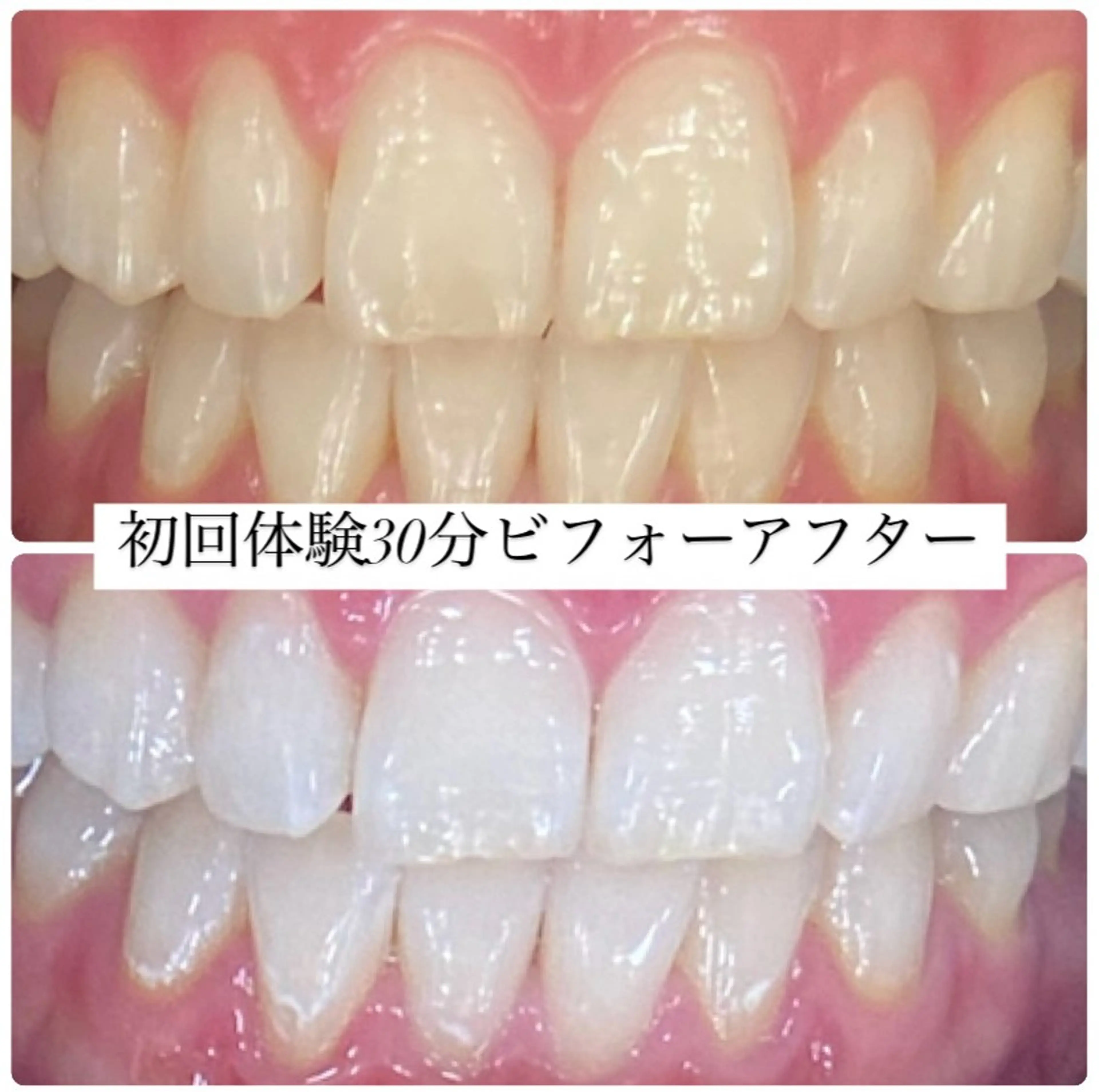 PLATINUM Beauty 横浜店所属・ホワイトニングルーム 横浜店のその他イメージ