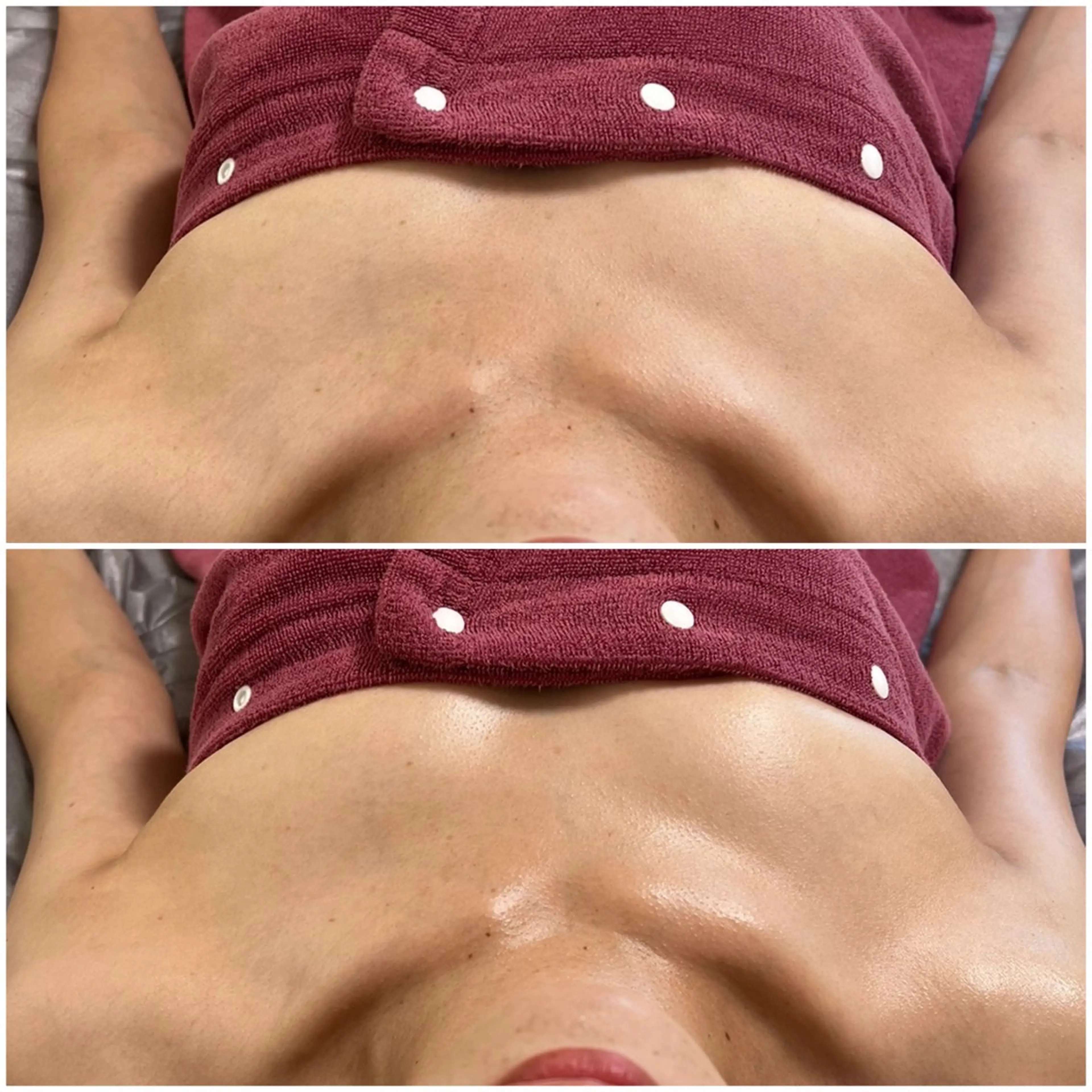 MELIA the beauty所属・肌のお悩み改善サロン MELIA/朋美のエステ・リラクイメージ