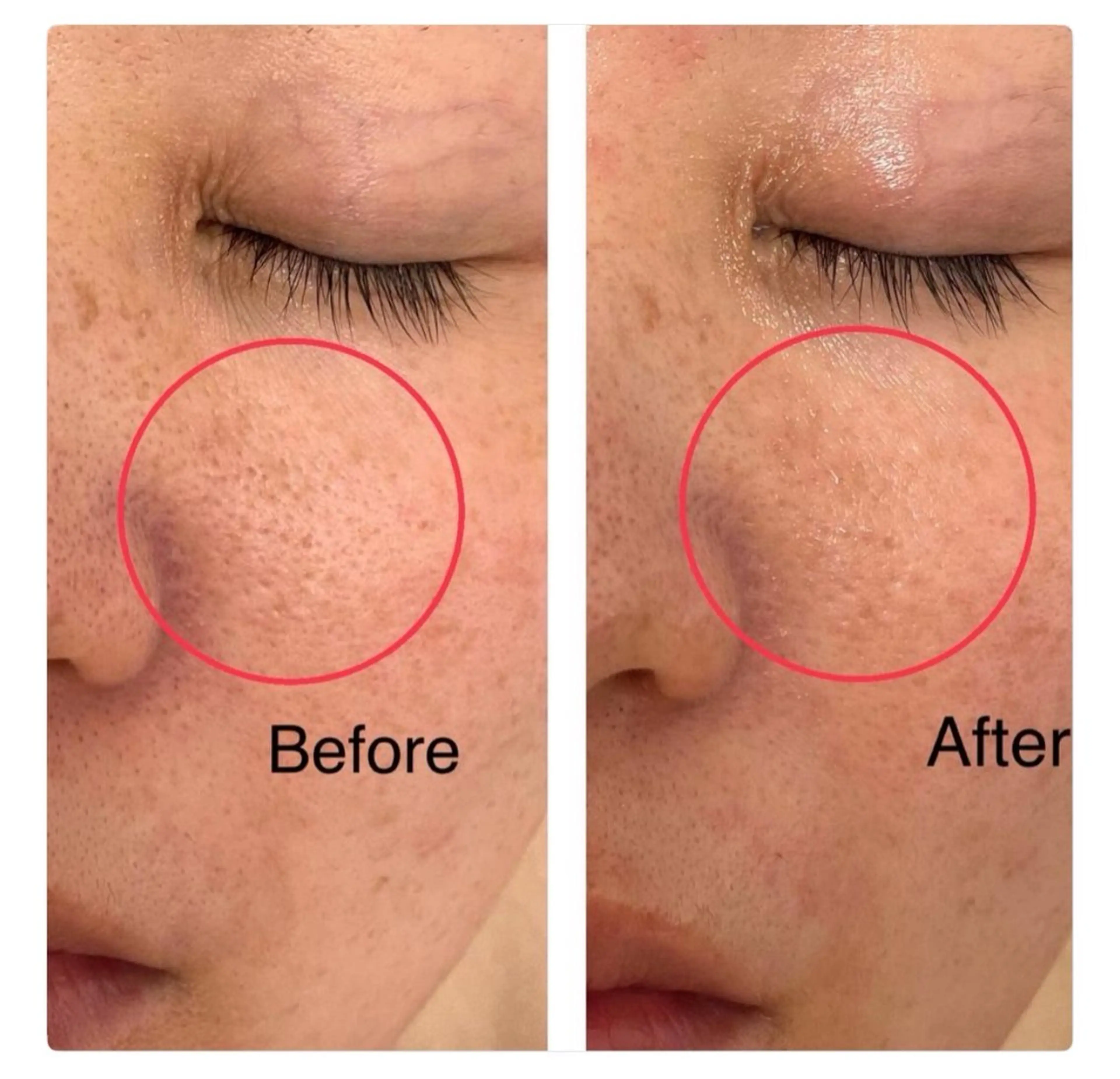 エステ 【堺市/泉ヶ丘駅】フェイシャルエステサロンSalon de jewel'm所属・Salon de jewel'm なおのエステ・リラクイメージ