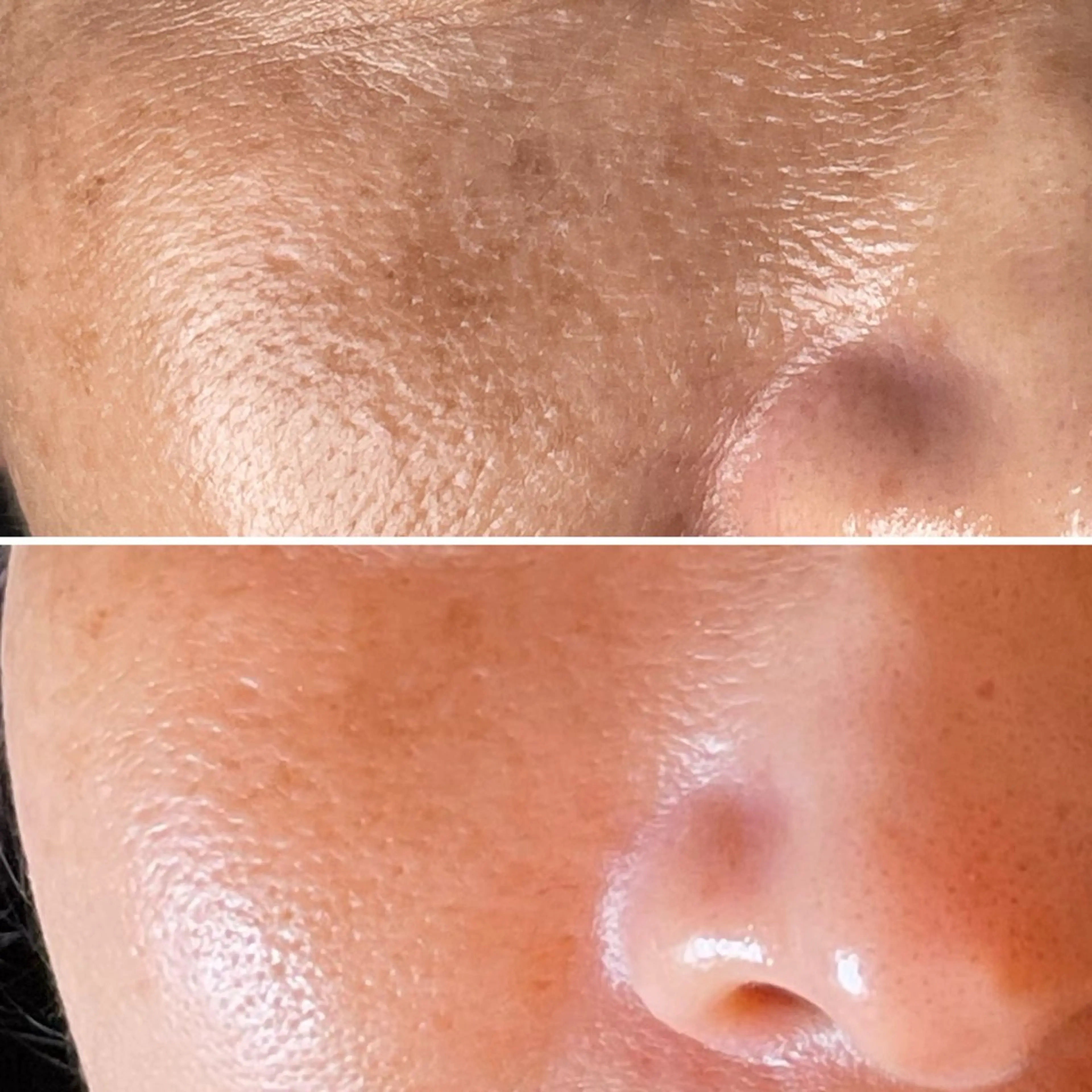 エステ sprinkles loungeのエステ・リラクイメージ