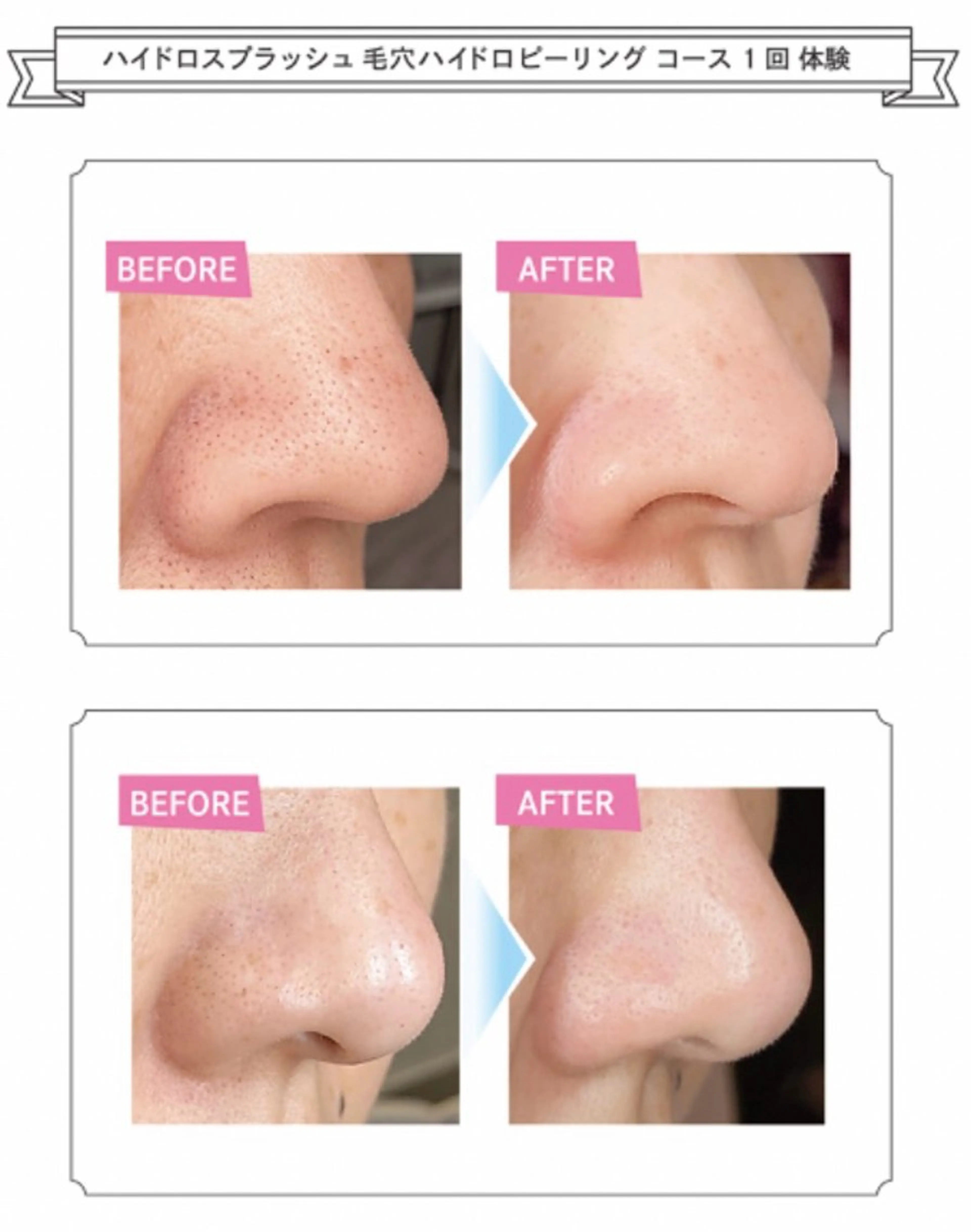 よもぎ蒸し&リラクゼーションサロンcocon所属・今橋 麻希のエステ・リラクイメージ