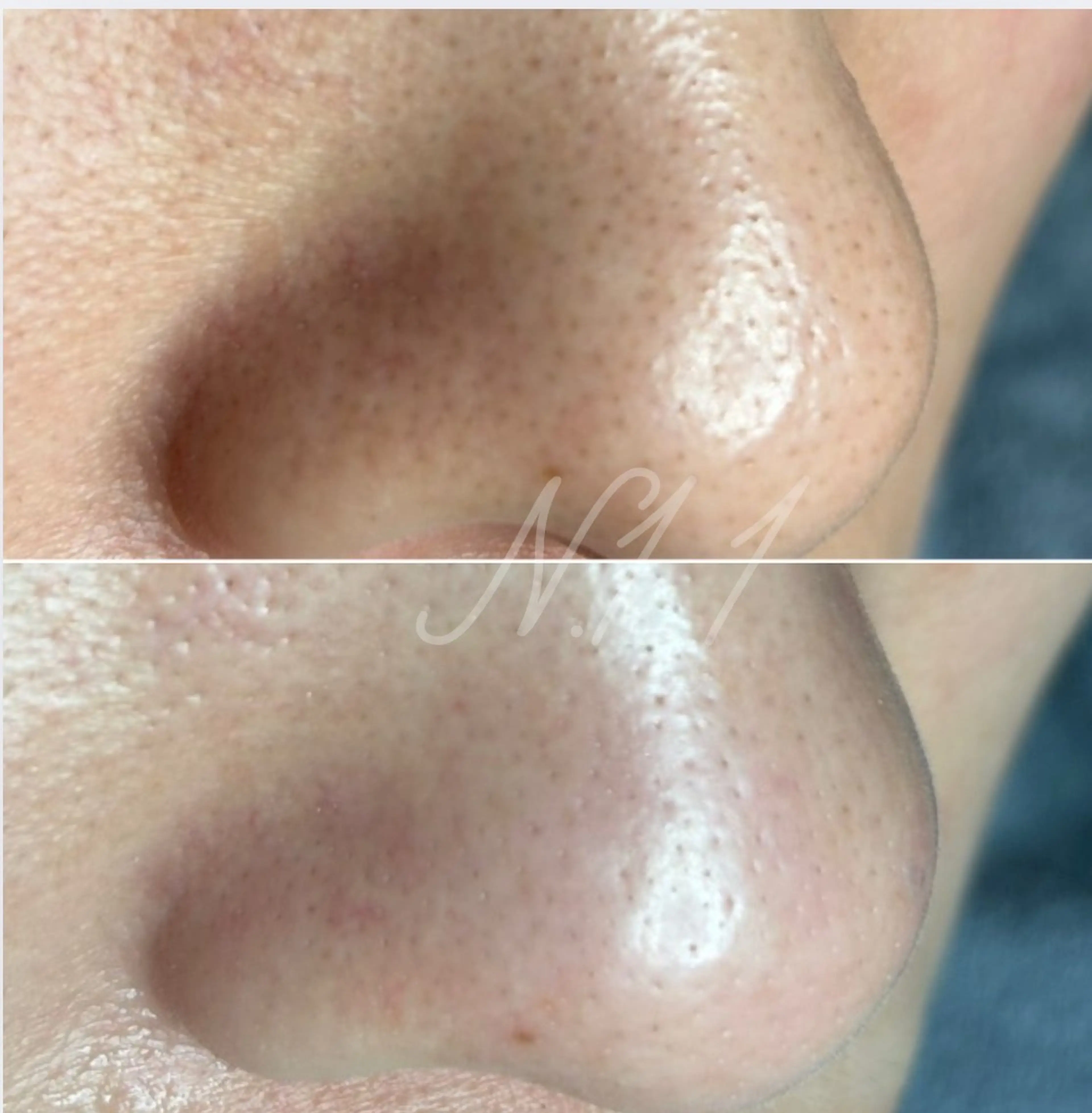 エステ beauty salon N.11所属・beauty salonN.11のエステ・リラクイメージ