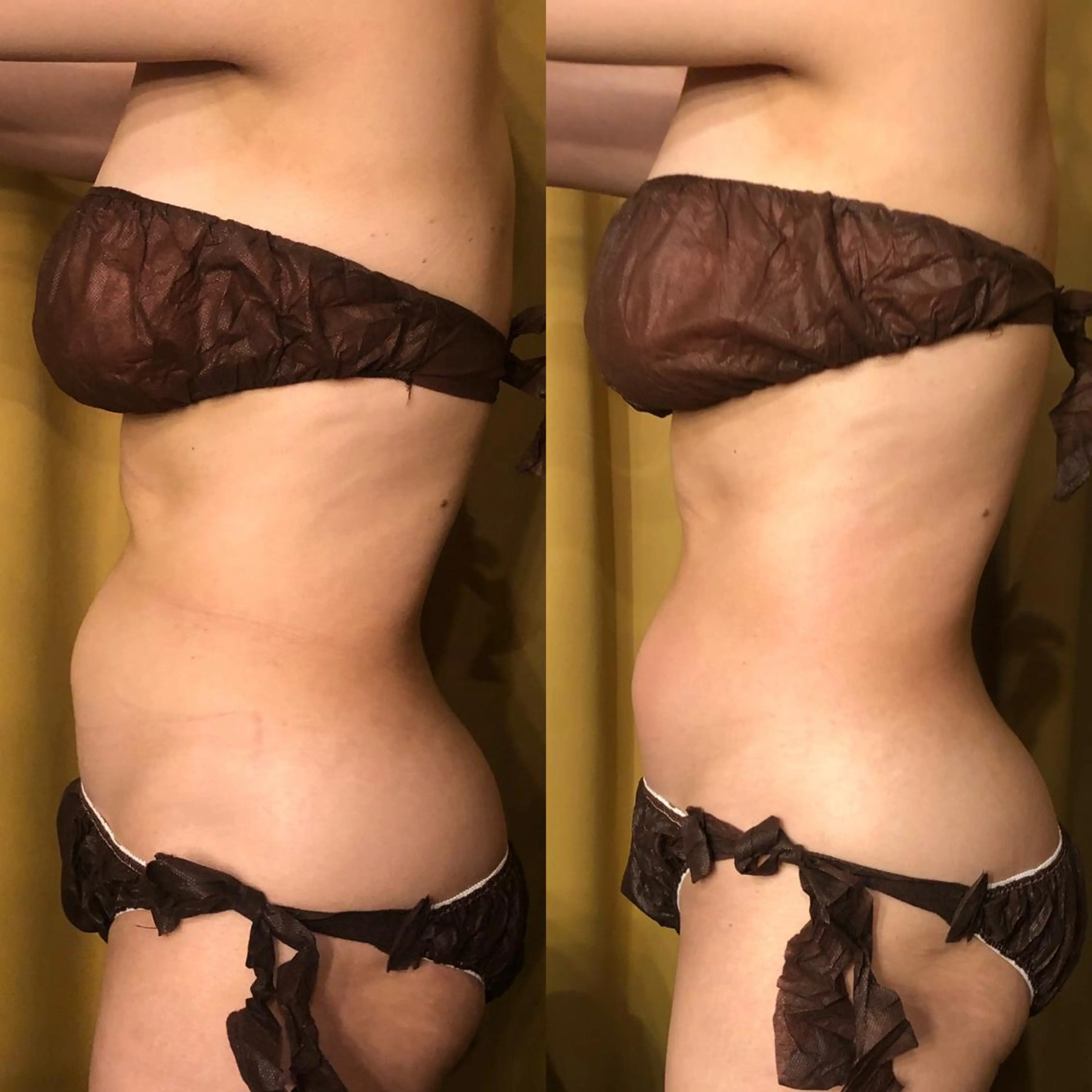 小顔＆痩身✨長谷川 ノリコのエステ・リラクイメージ