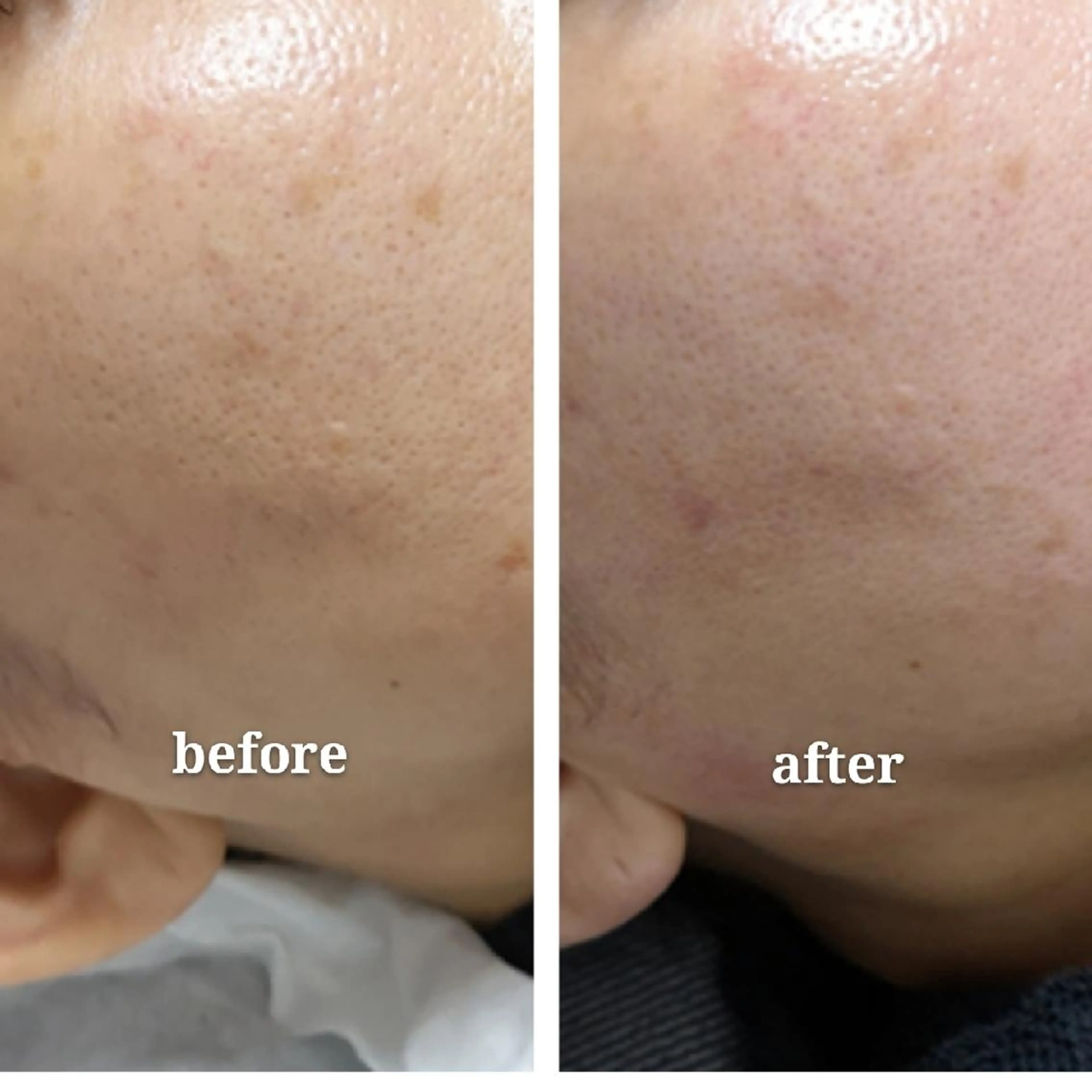 🅖🅤🅩🅔🅛 salonのエステ・リラクイメージ