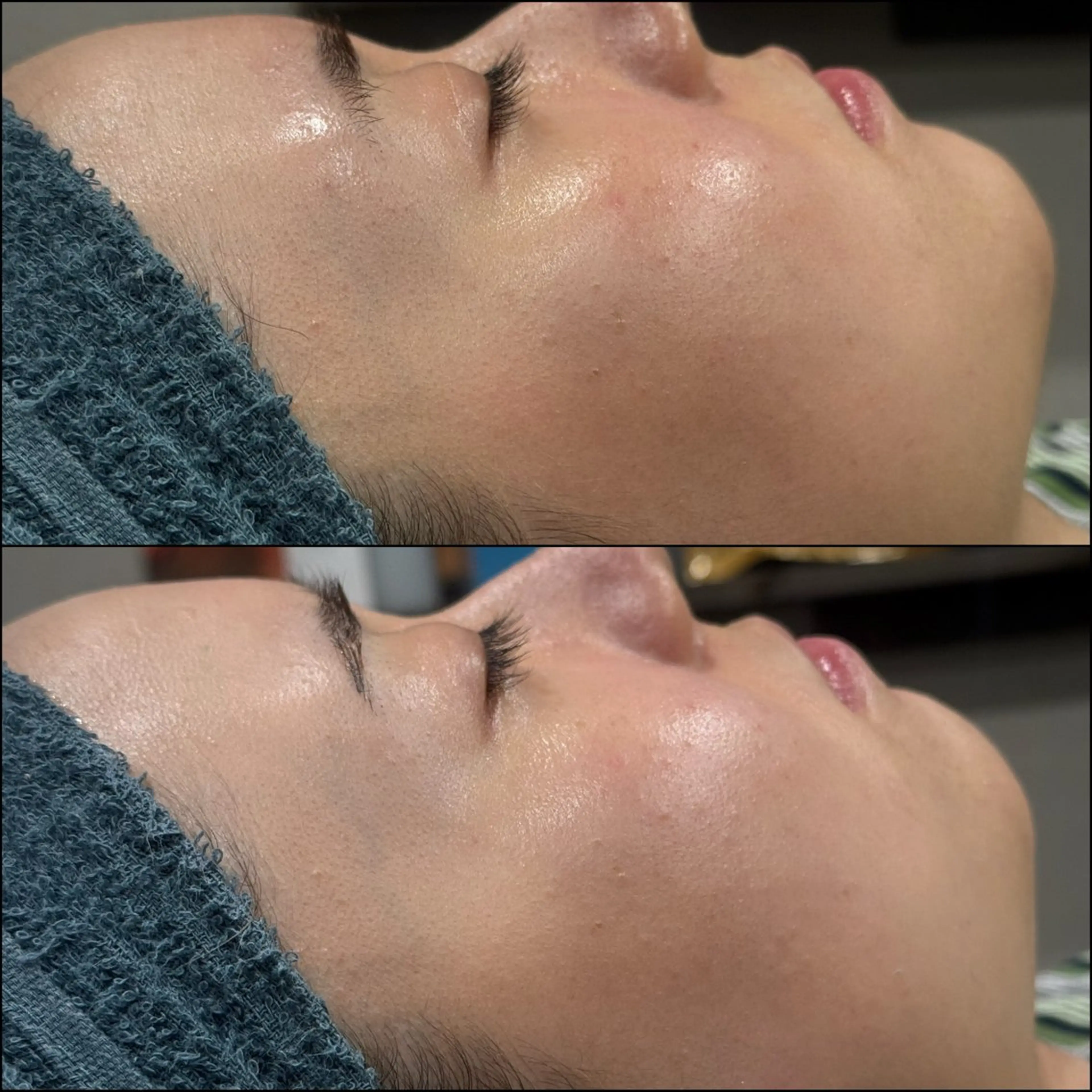 脱毛 LiZA エステティックサロンのエステ・リラクイメージ