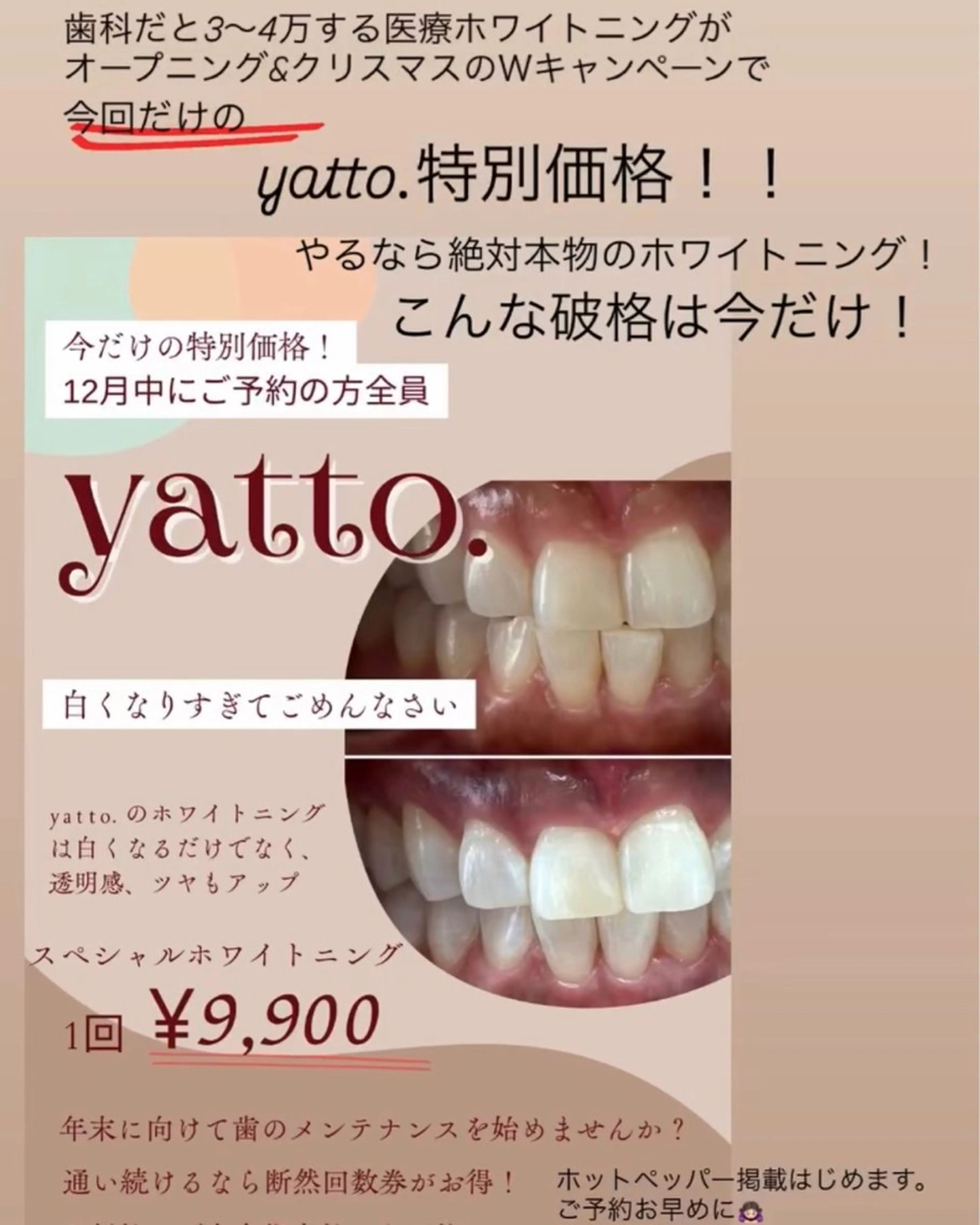 whitening salon yatto.所属・ホワイトニングサロン yatto.のその他イメージ