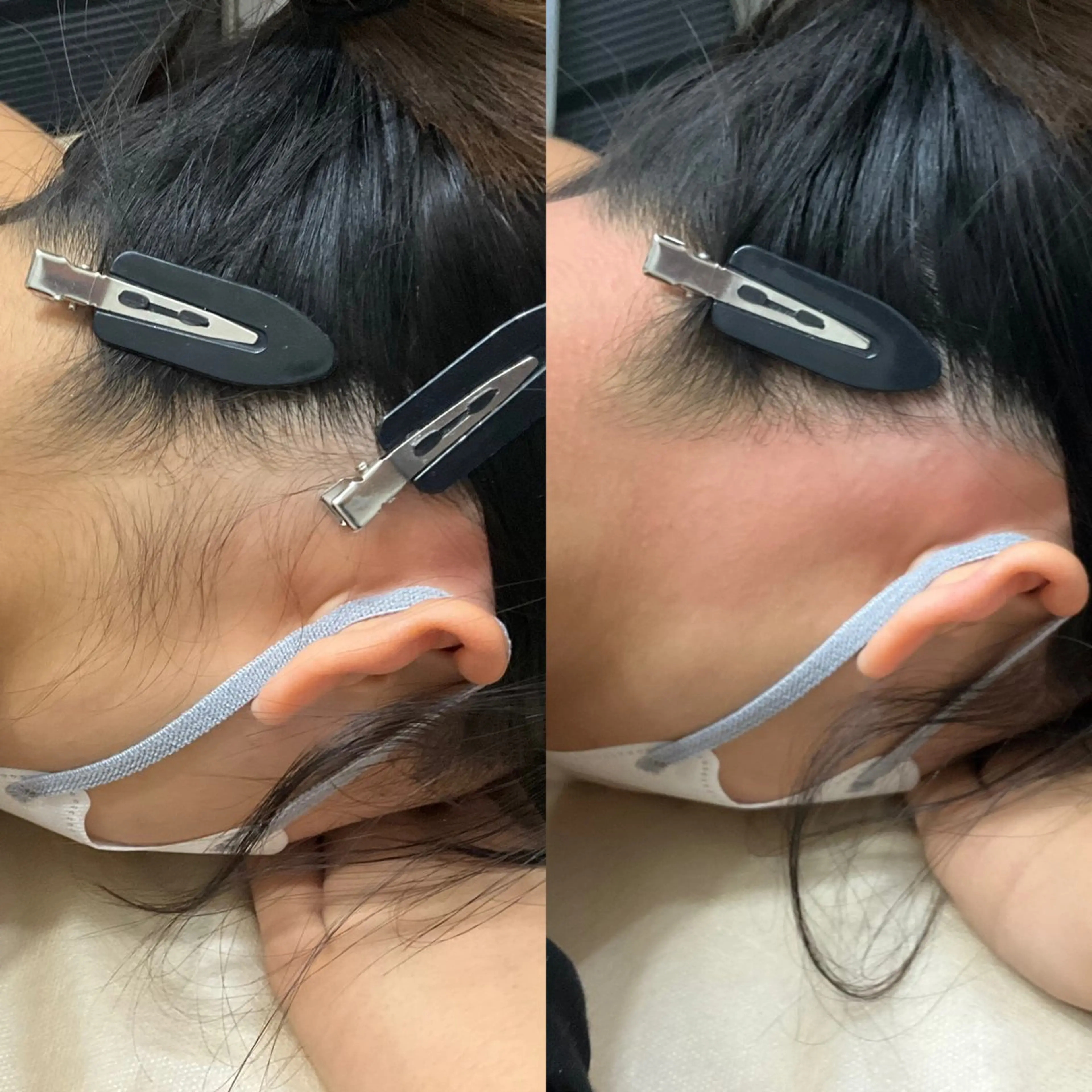 脱毛サロンBloom所属・Nami シュガーリングサロンのエステ・リラクイメージ