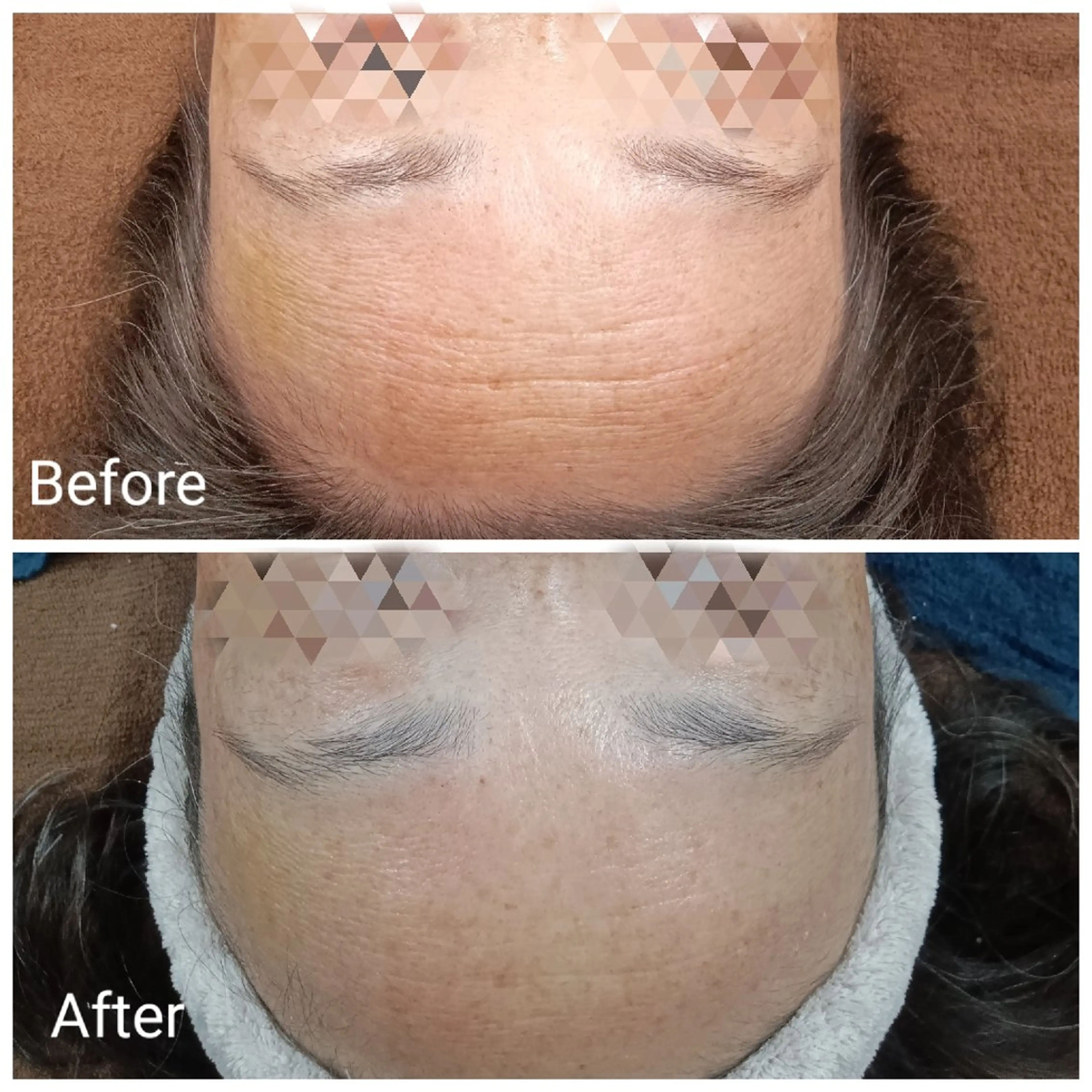 エステ リラク 肌質改善Beauty salon Renのエステ・リラクイメージ