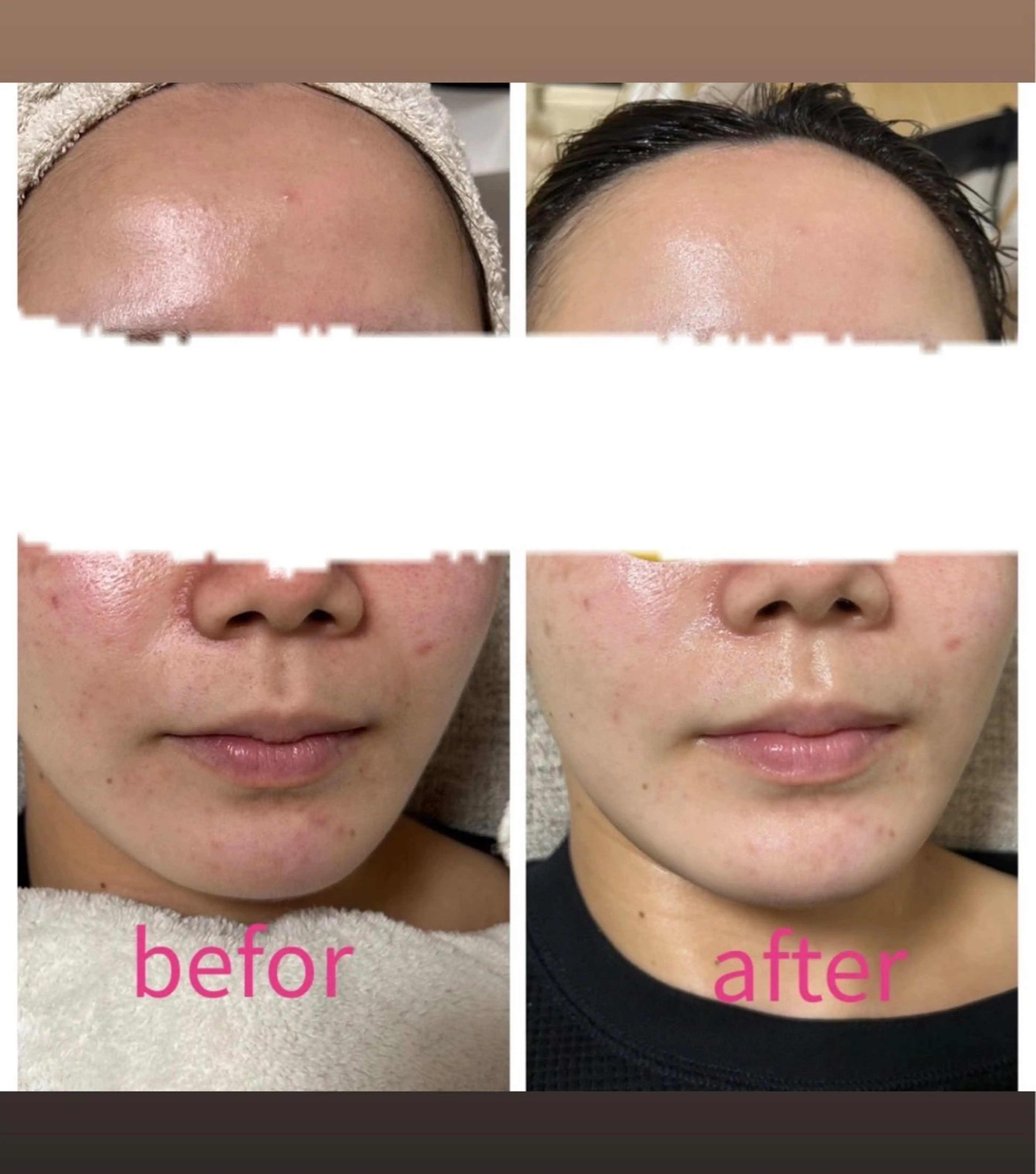 ホワイトコースの写真