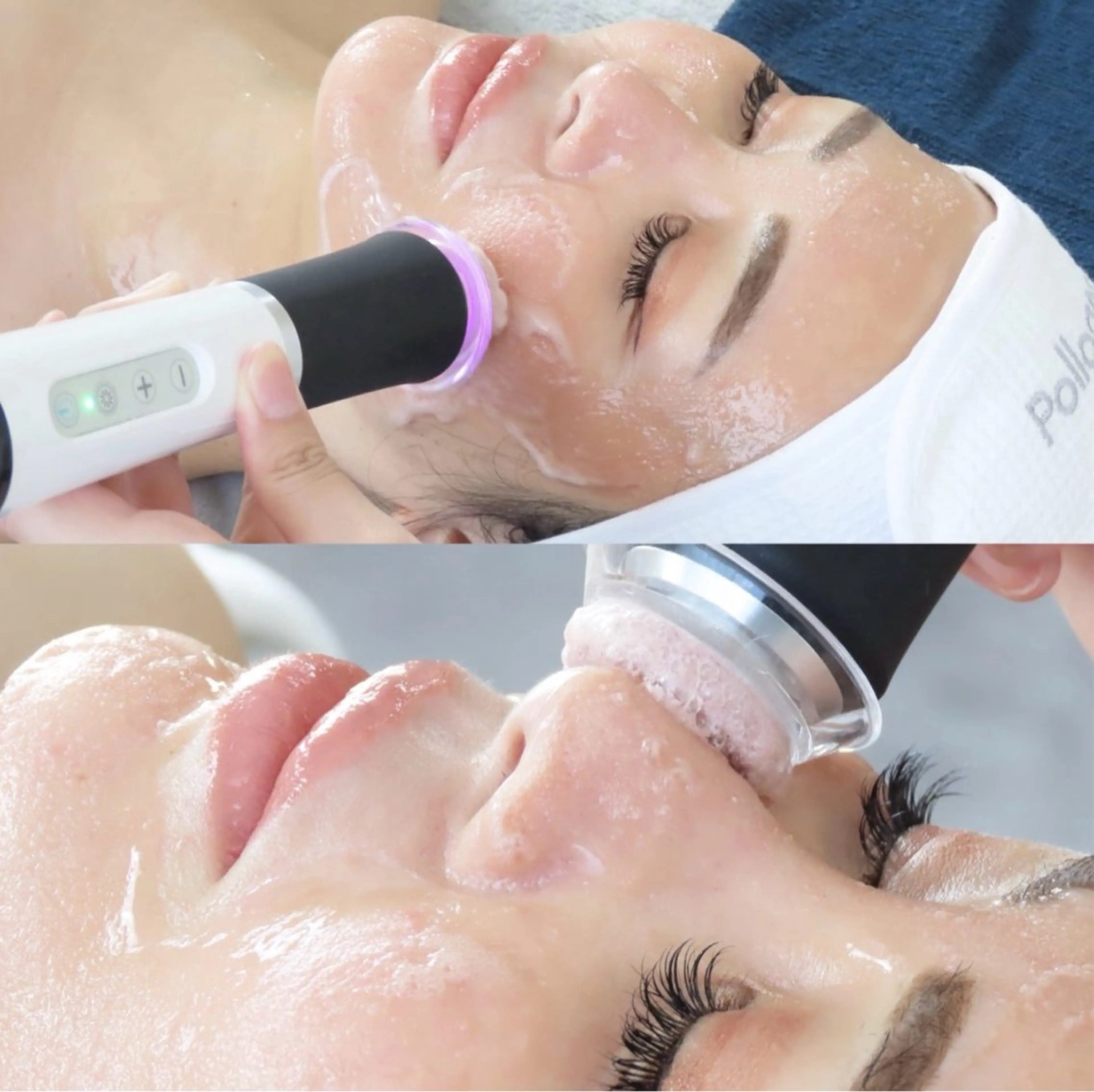 【本気肌育🫧】肌荒れ＆敏感肌にも◎高濃度炭酸ピーリング→超音波導入→パックの写真