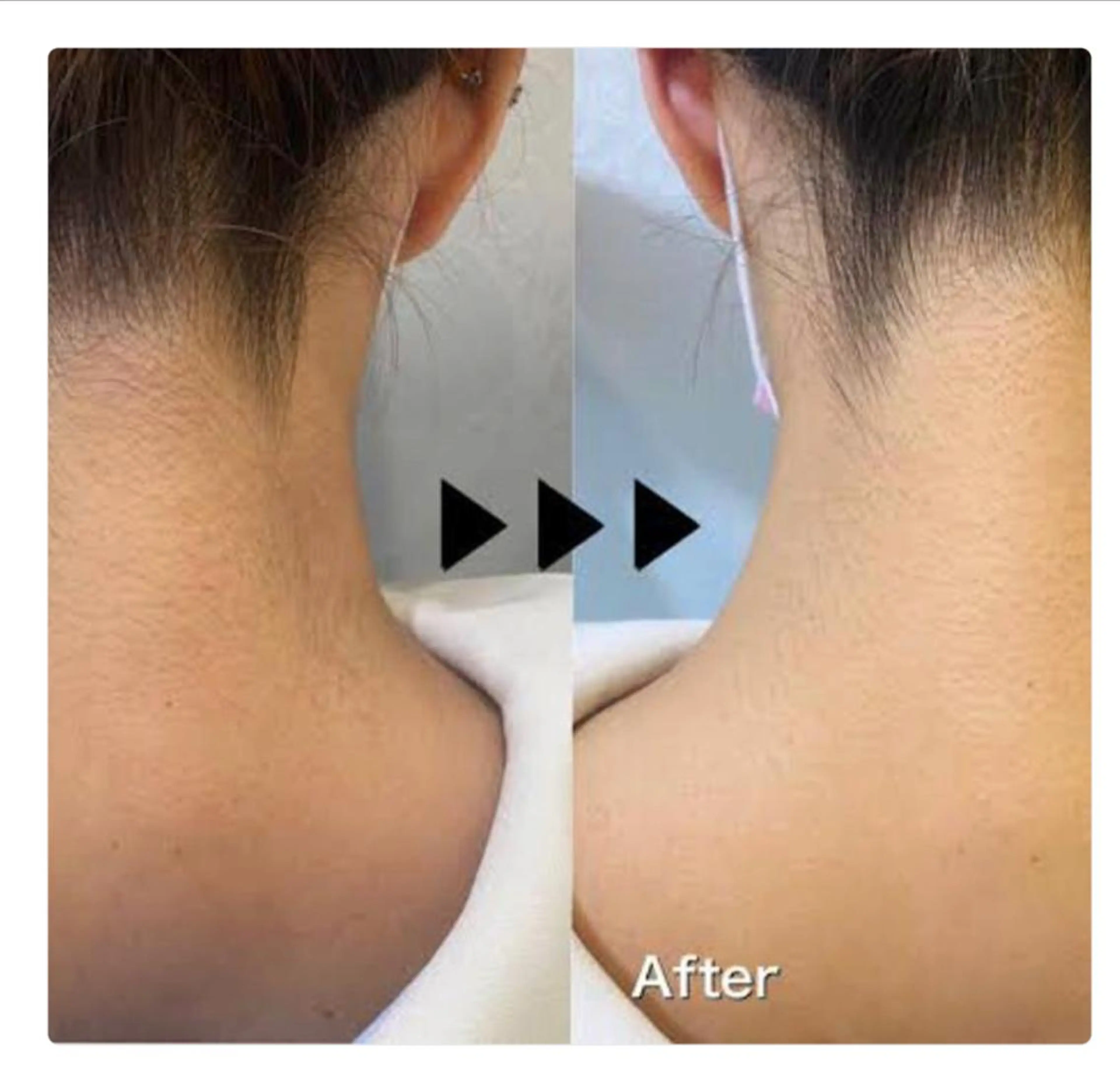 ロング カラー メンズ マツエク・マツパ アイブロウ メンズアイブロウ 眉毛ワックス脱毛 結婚式・ブライダル 都度払い脱毛⭐️ 脱毛サロンMIRACのエステ・リラクイメージ