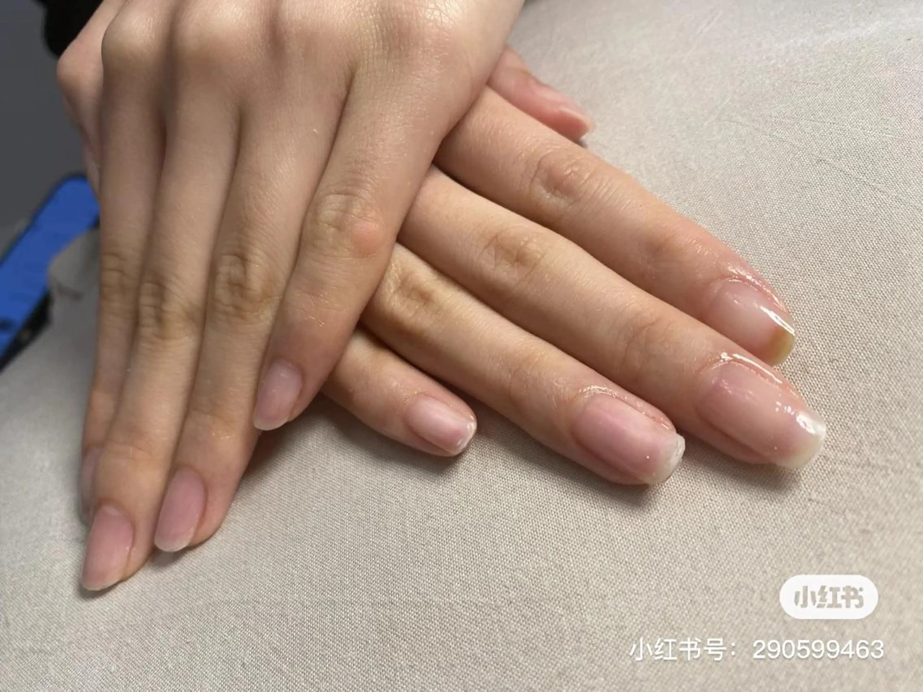ネイル Hana  NAIL所属・新宿YISInail スカルプ専門店のネイルデザイン