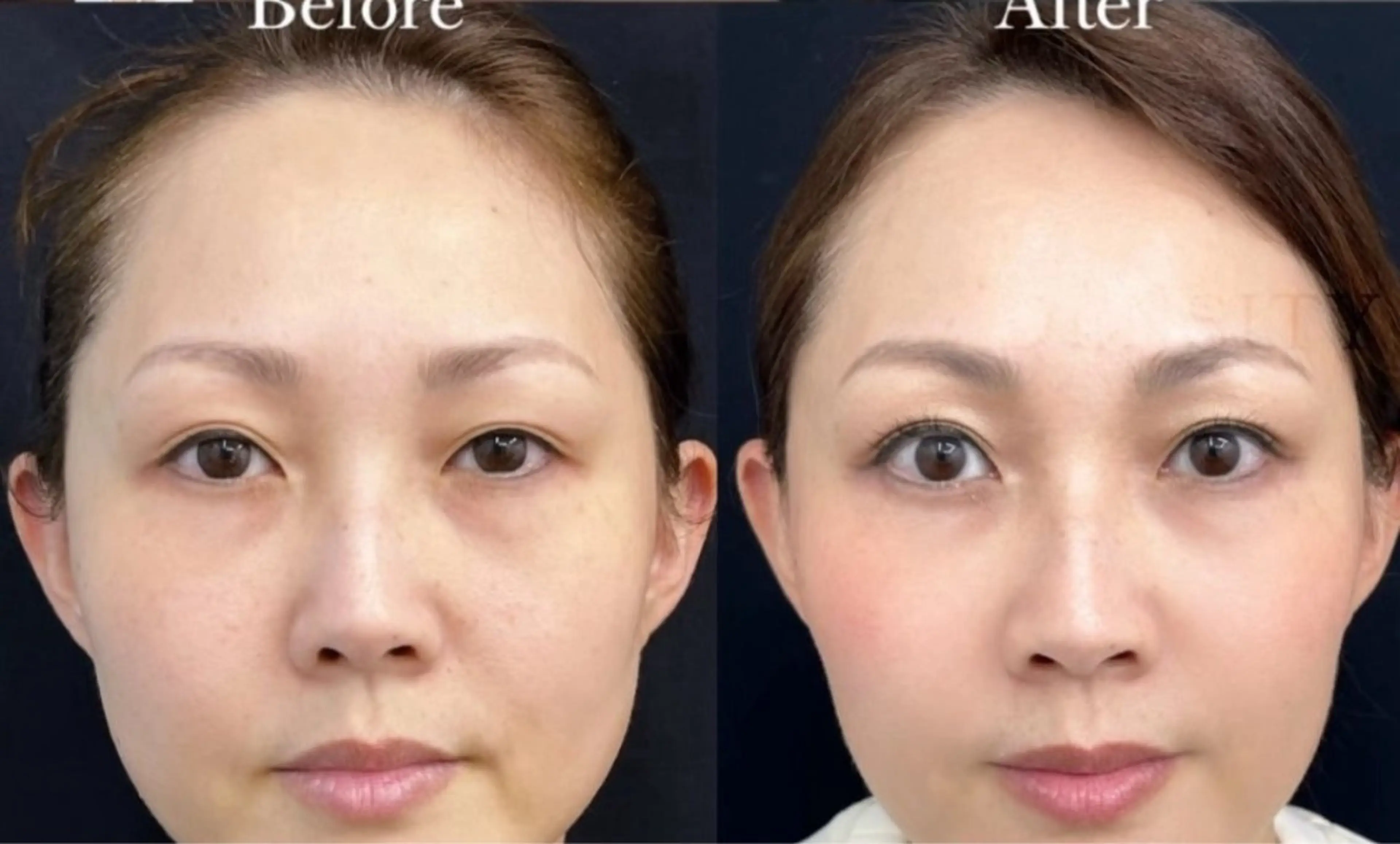 マツエク・マツパ エステ aliaハイフ&水光ジェットサロン所属・aliaハーブ水光店 エステティシャン募集のエステ・リラクイメージ