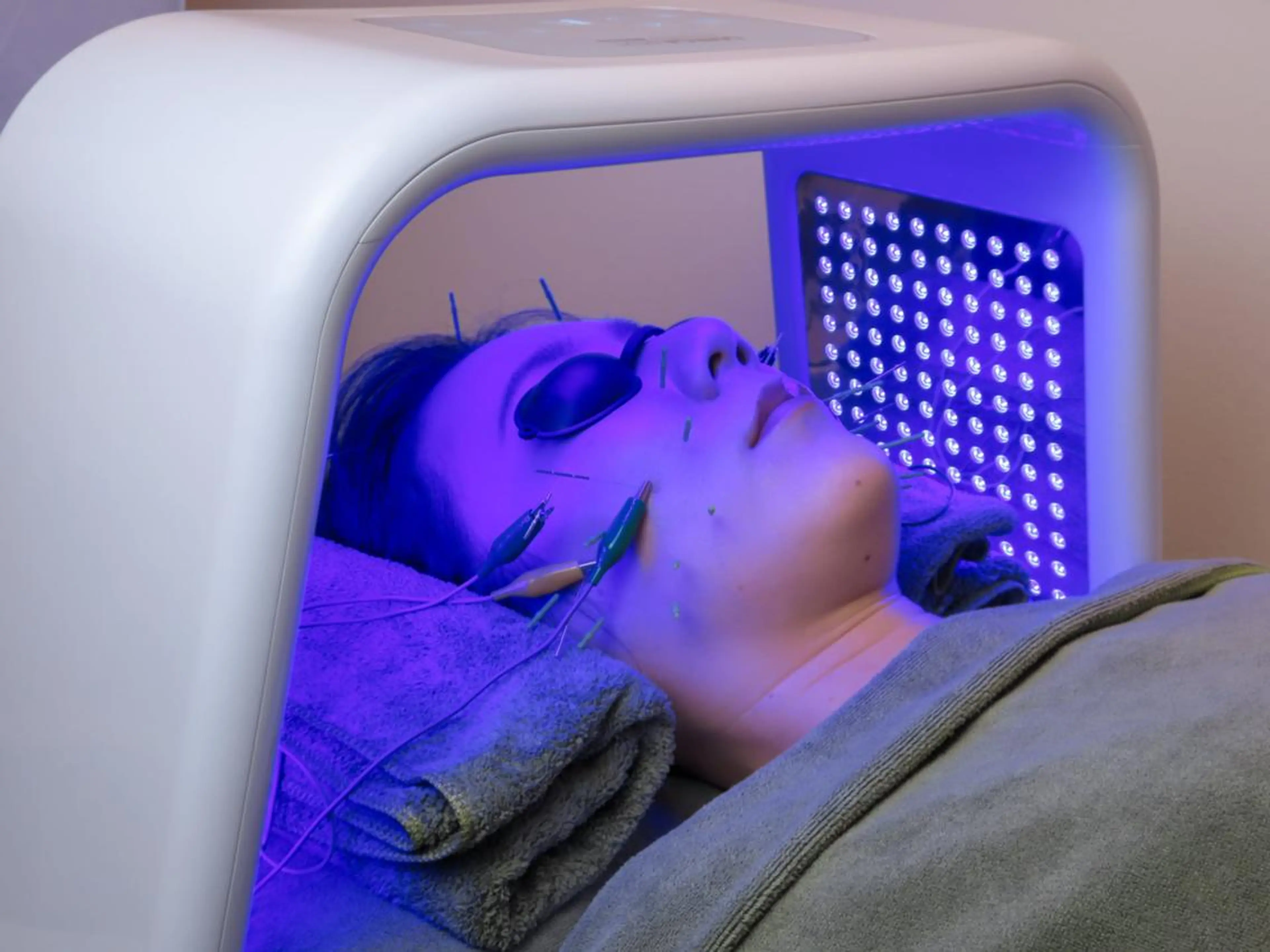 美容とカラダの鍼灸 サロン やなけんのエステ・リラクイメージ